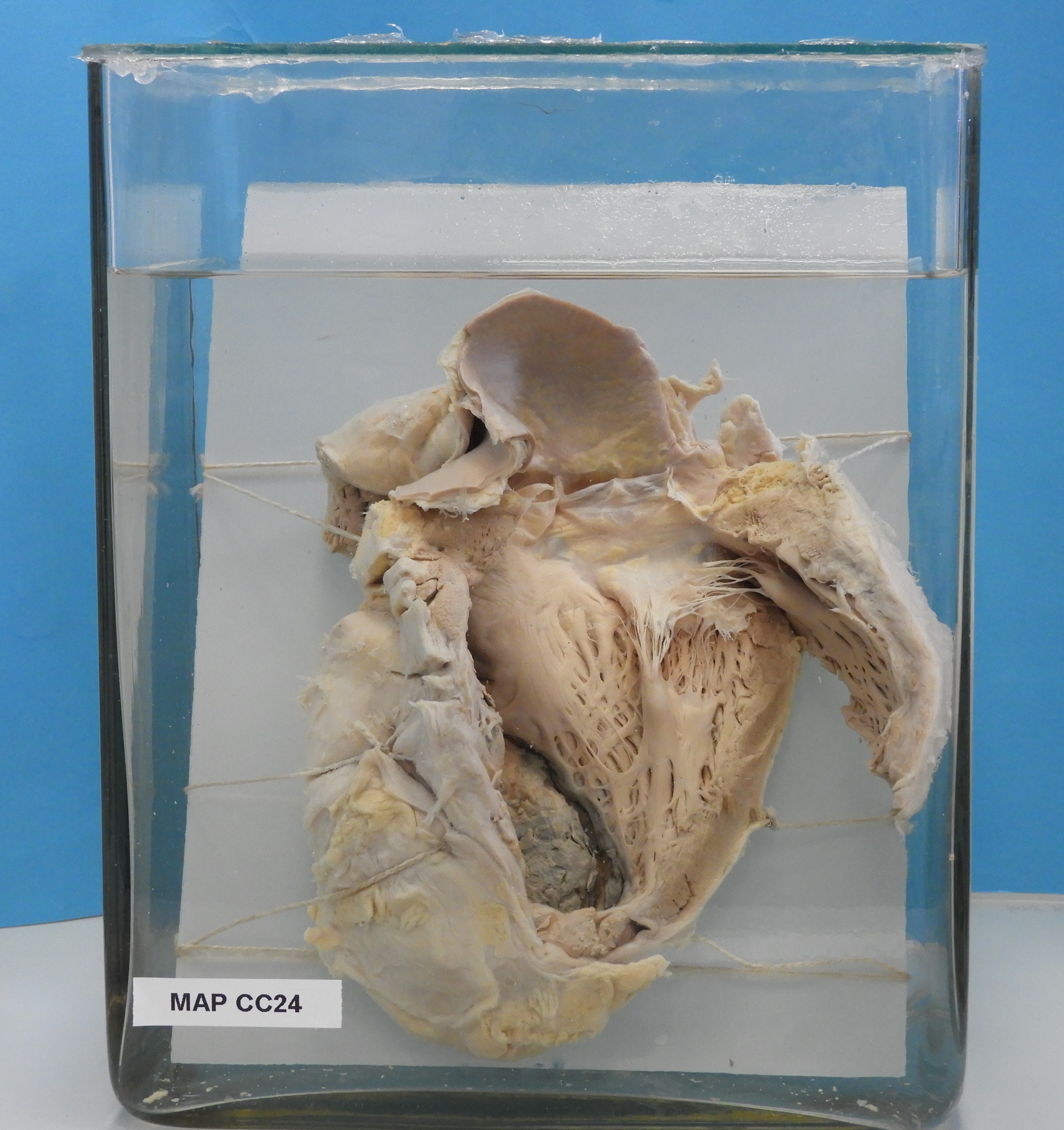 preparato anatomico, apparato cardiocircolatorio (morfologia naturale) (SECOLI/ XX)