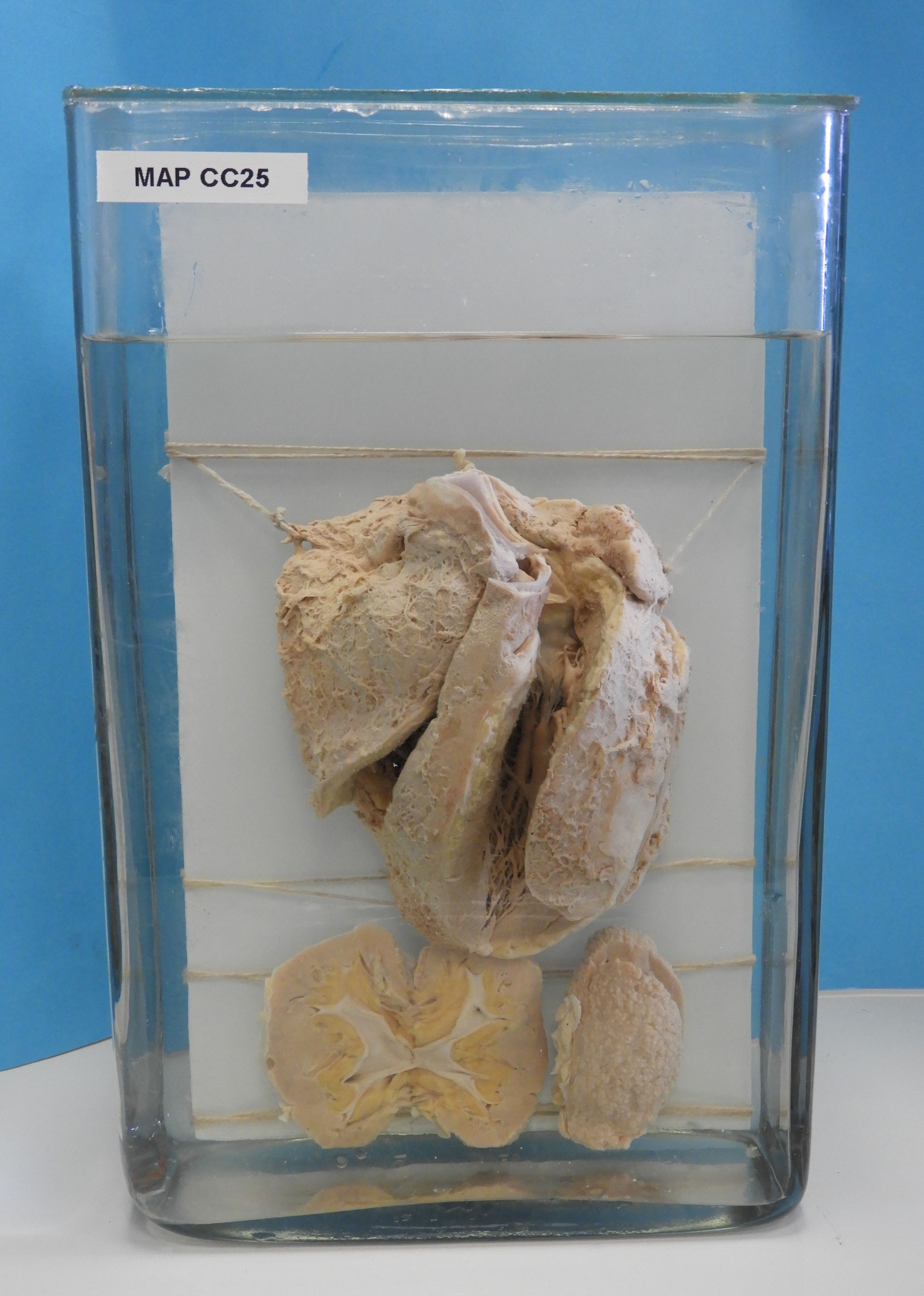 preparato anatomico, apparato cardiocircolatorio (morfologia naturale) (SECOLI/ XX)