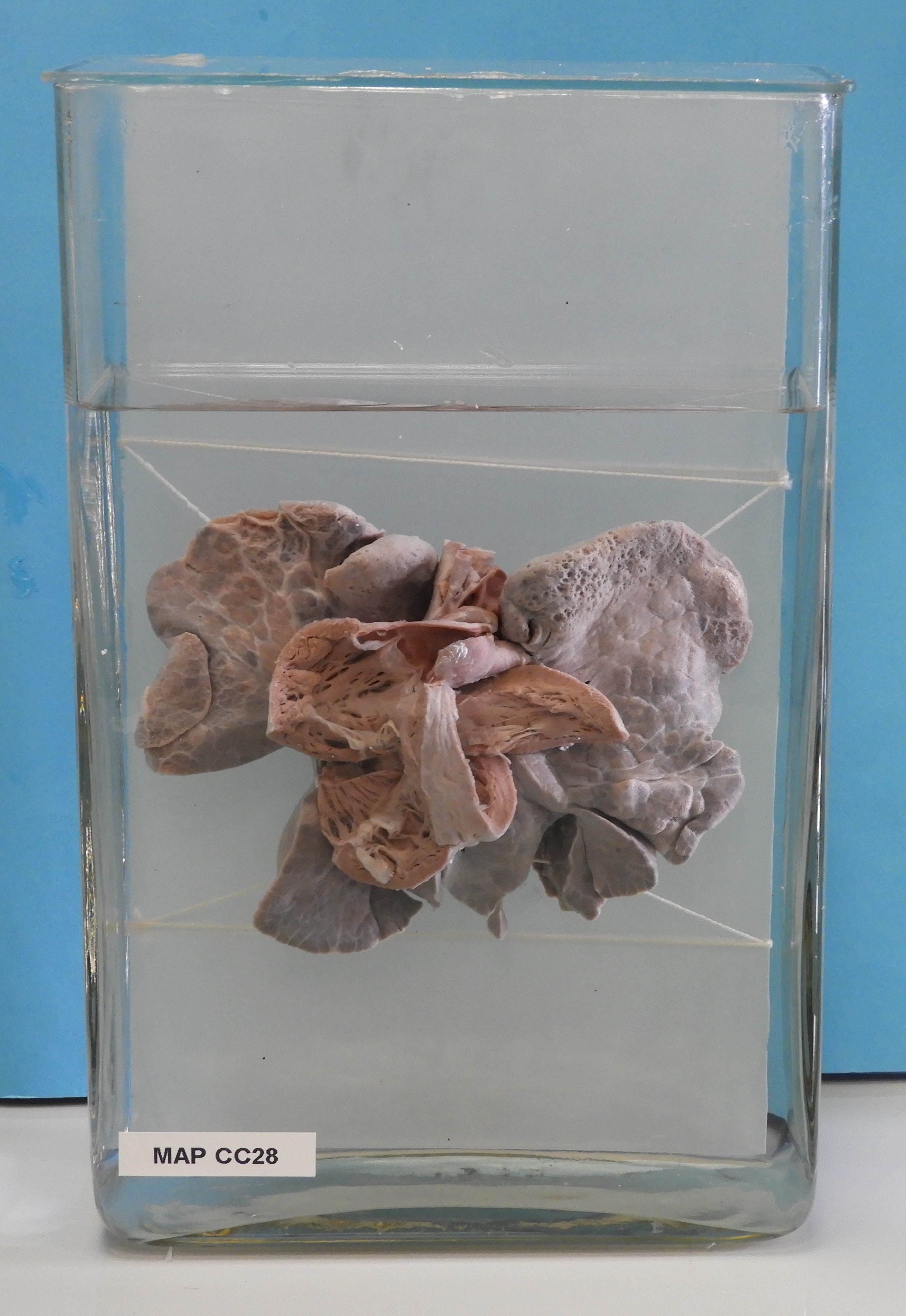 preparato anatomico, apparato cardiocircolatorio (morfologia naturale) (SECOLI/ XX)