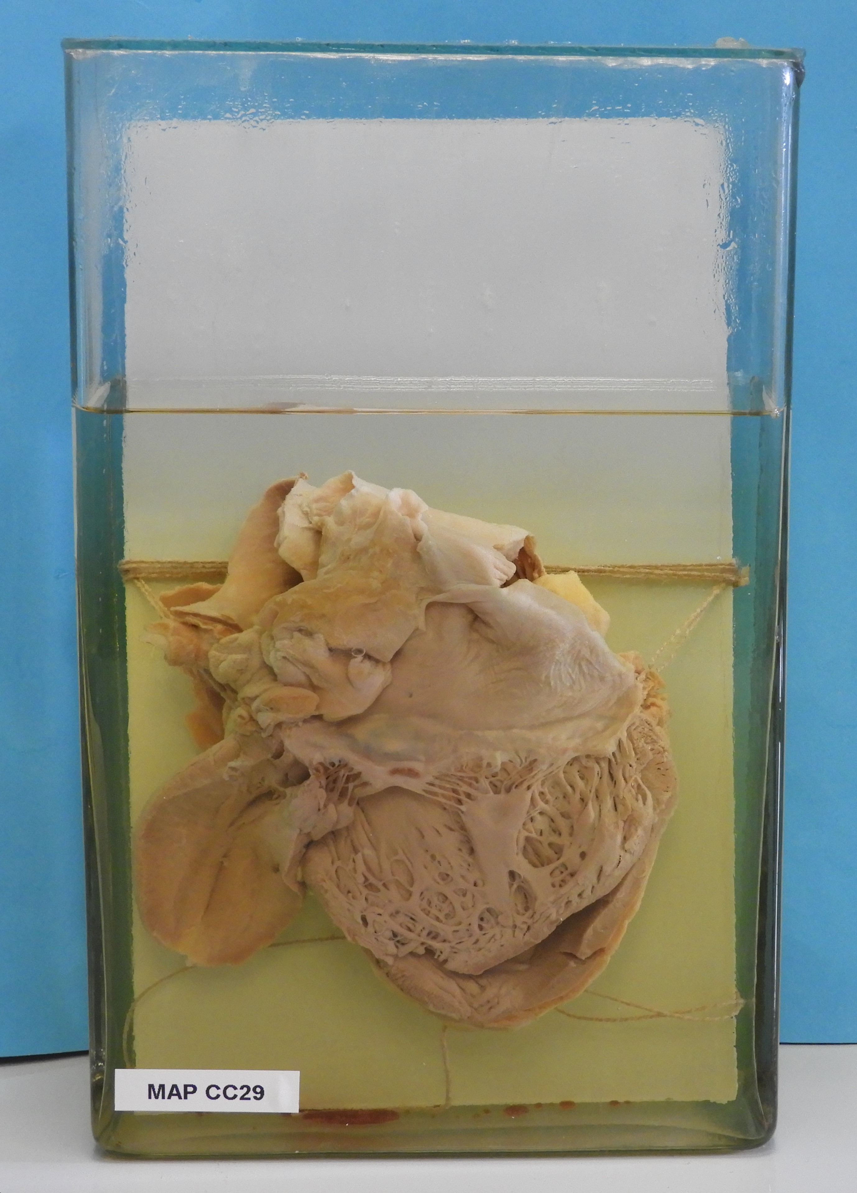 preparato anatomico, apparato cardiocircolatorio (morfologia naturale) (SECOLI/ XX)