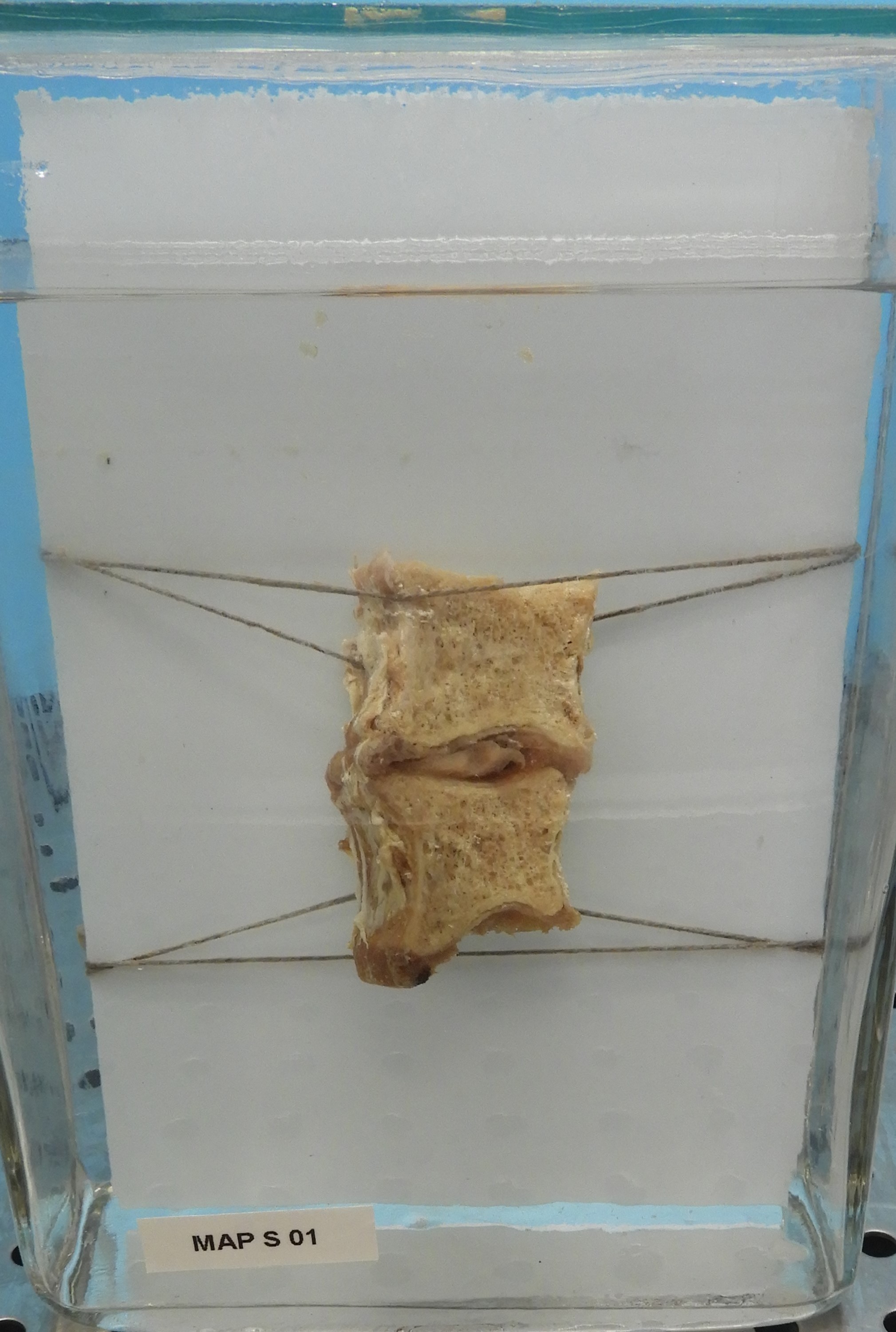 preparato anatomico, apparato cardiocircolatorio (morfologia naturale) (SECOLI/ XX)