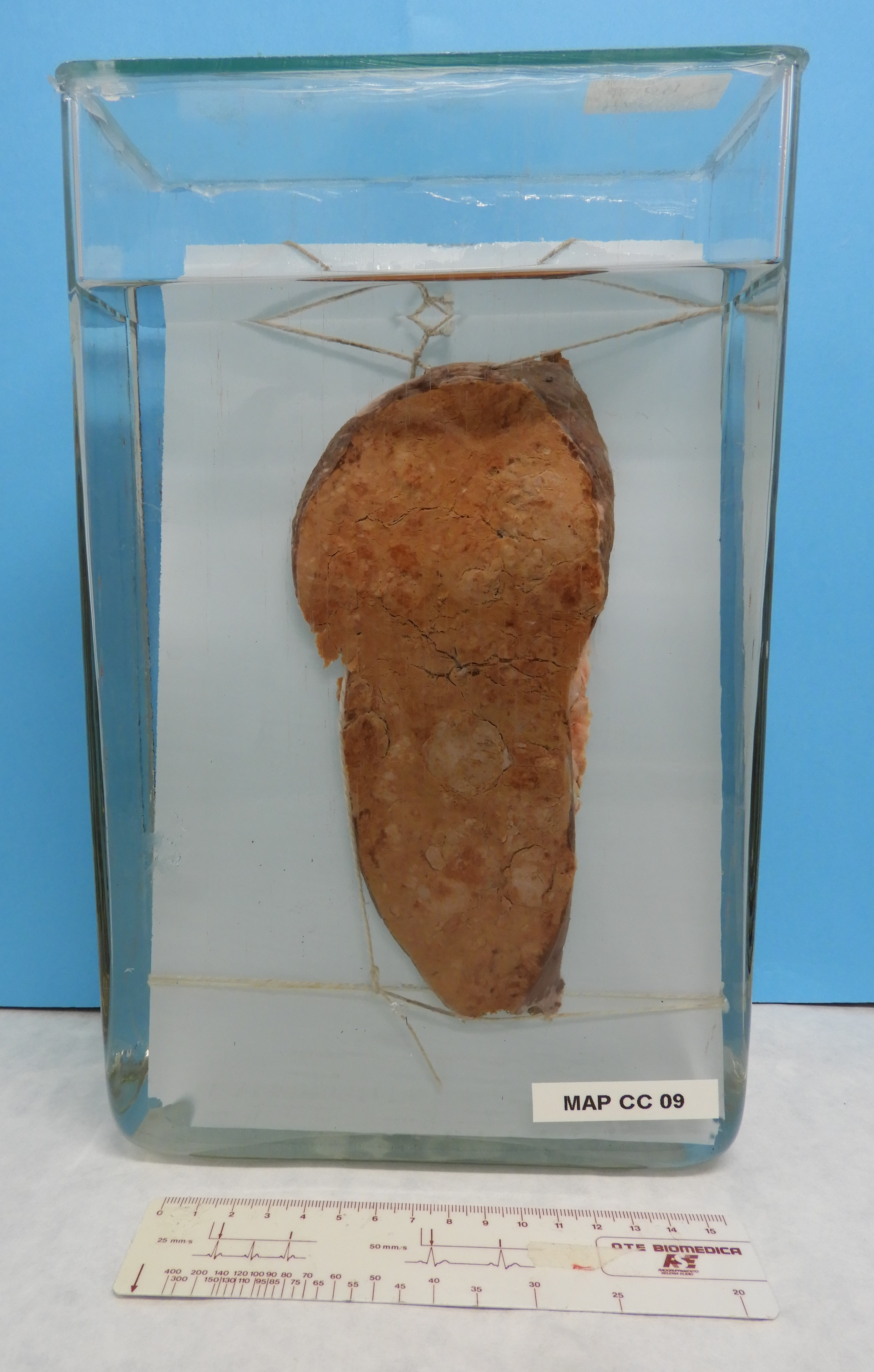 preparato anatomico, sistema linfatico (morfologia naturale) (SECOLI/ XX)