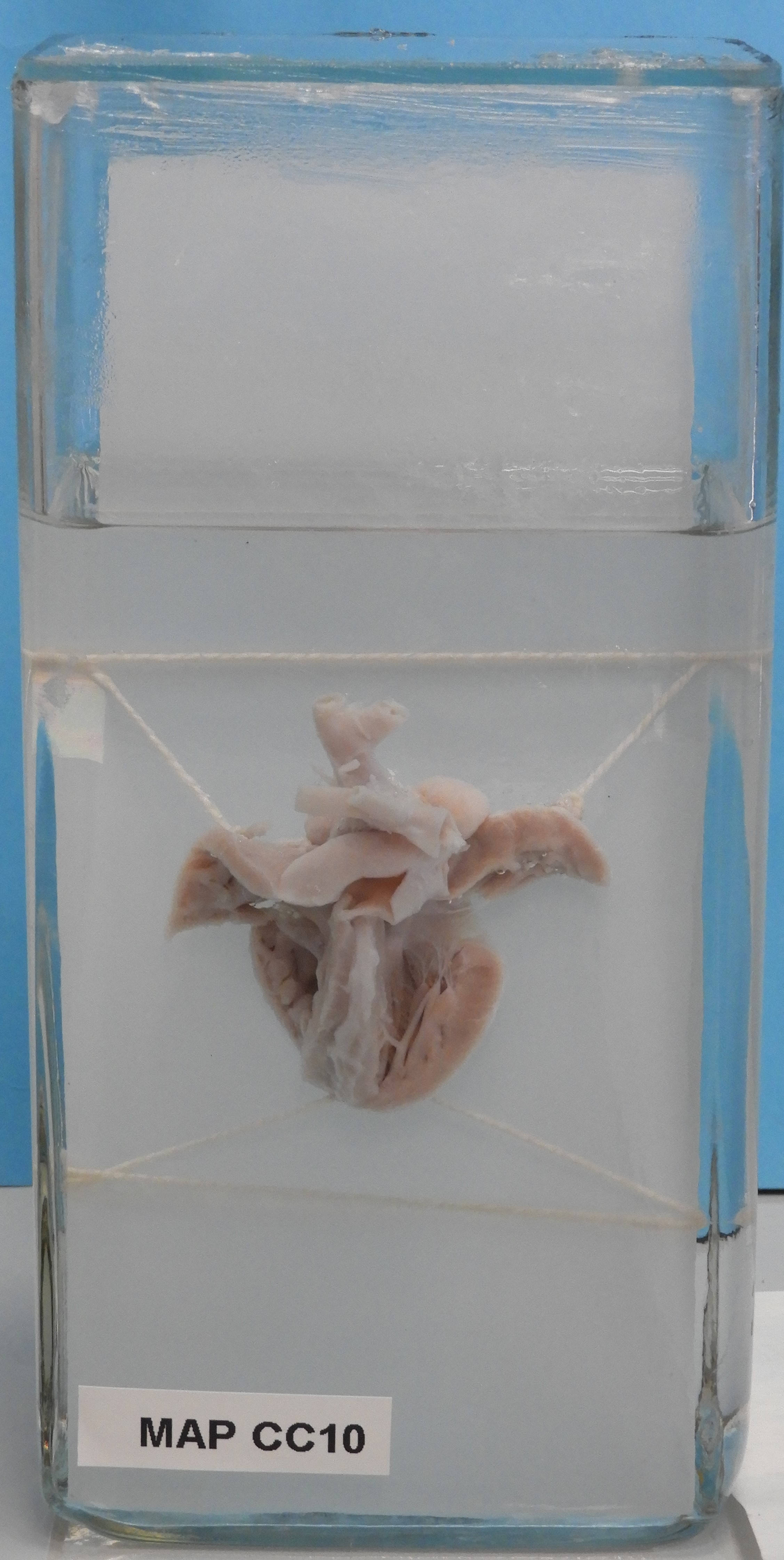 preparato anatomico, apparato cardiocircolatorio (morfologia naturale) (SECOLI/ XX)