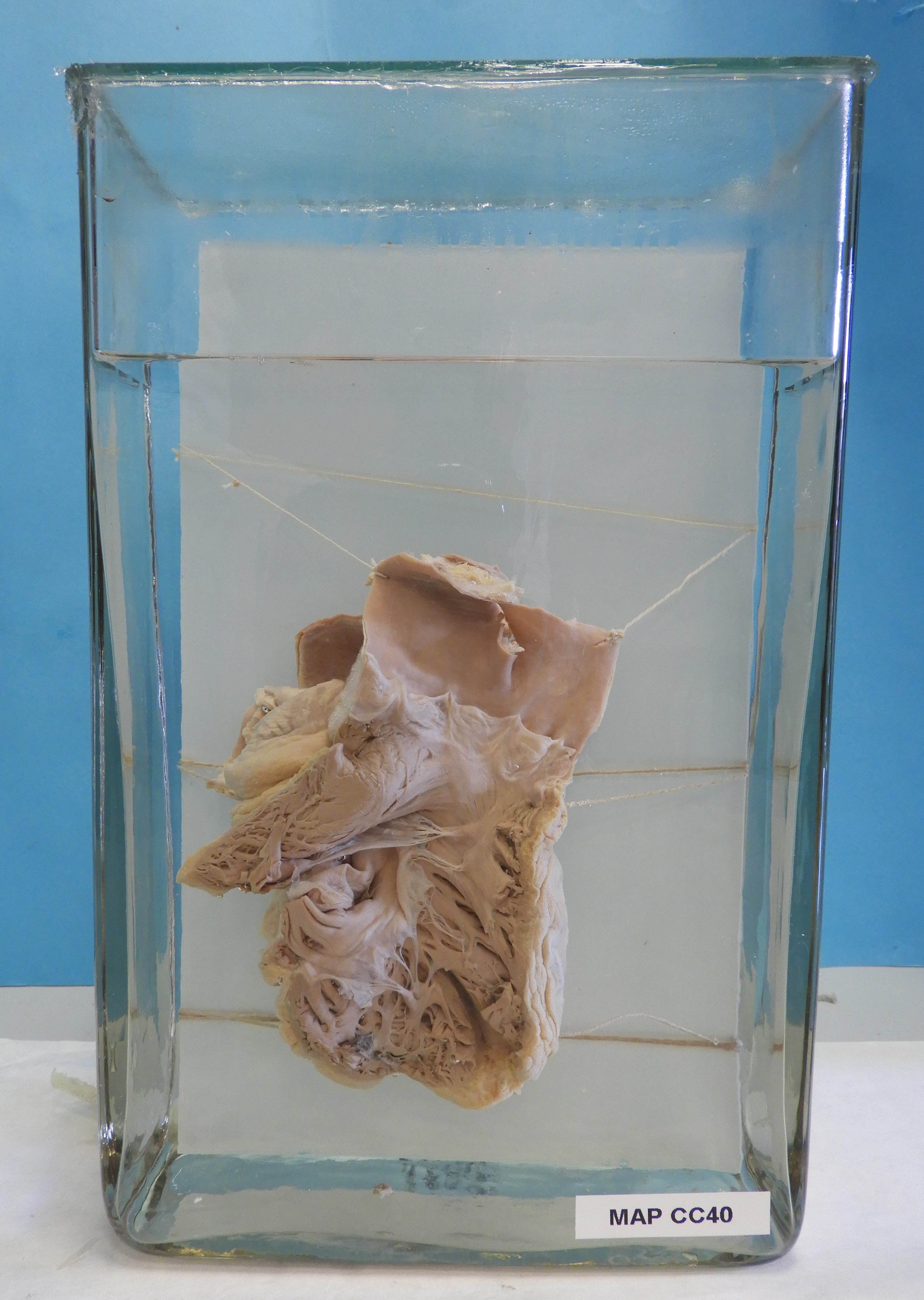 preparato anatomico, apparato cardiocircolatorio (morfologia naturale) (SECOLI/ XX)