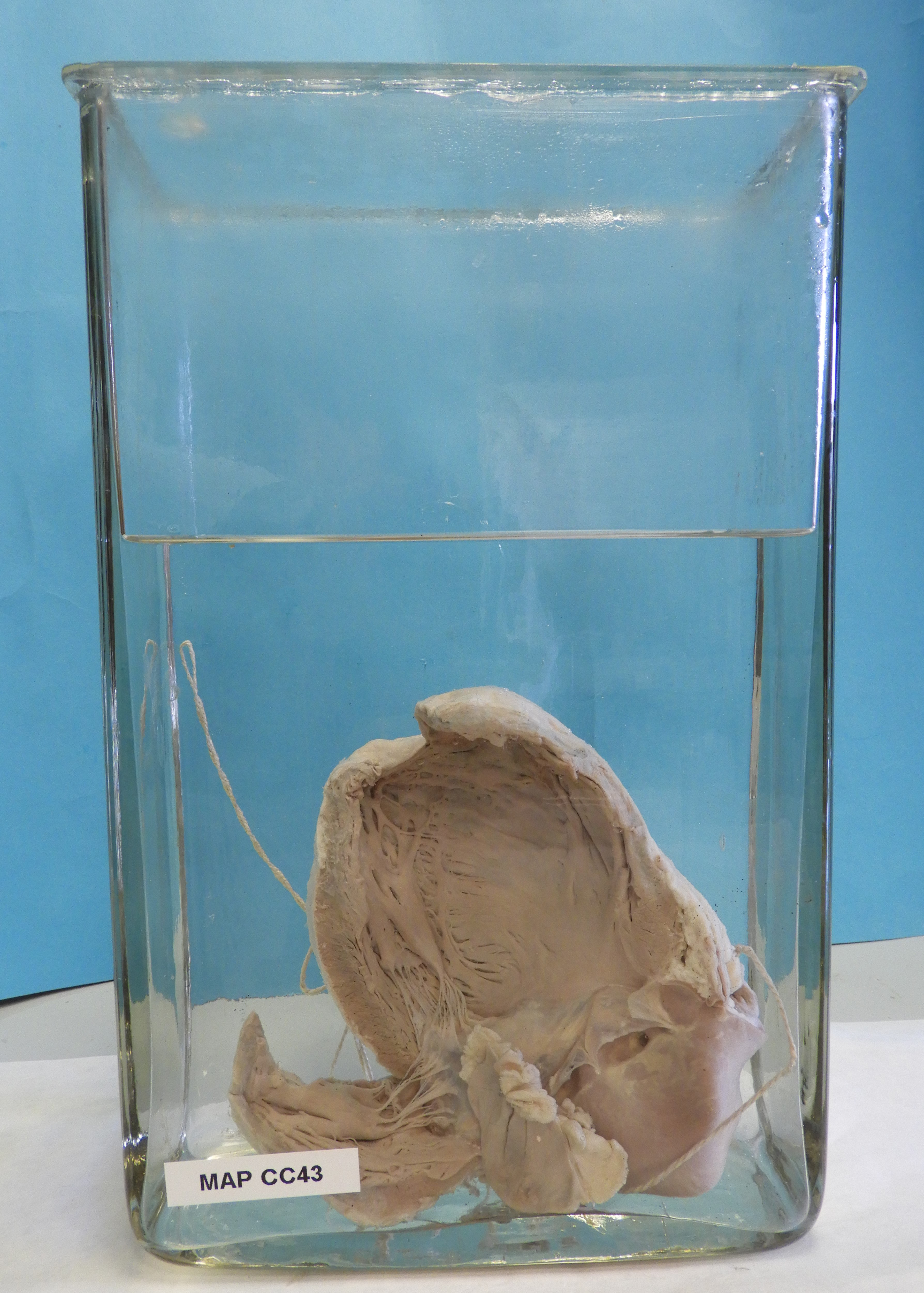 preparato anatomico, apparato cardiocircolatorio (morfologia naturale) (SECOLI/ XX)