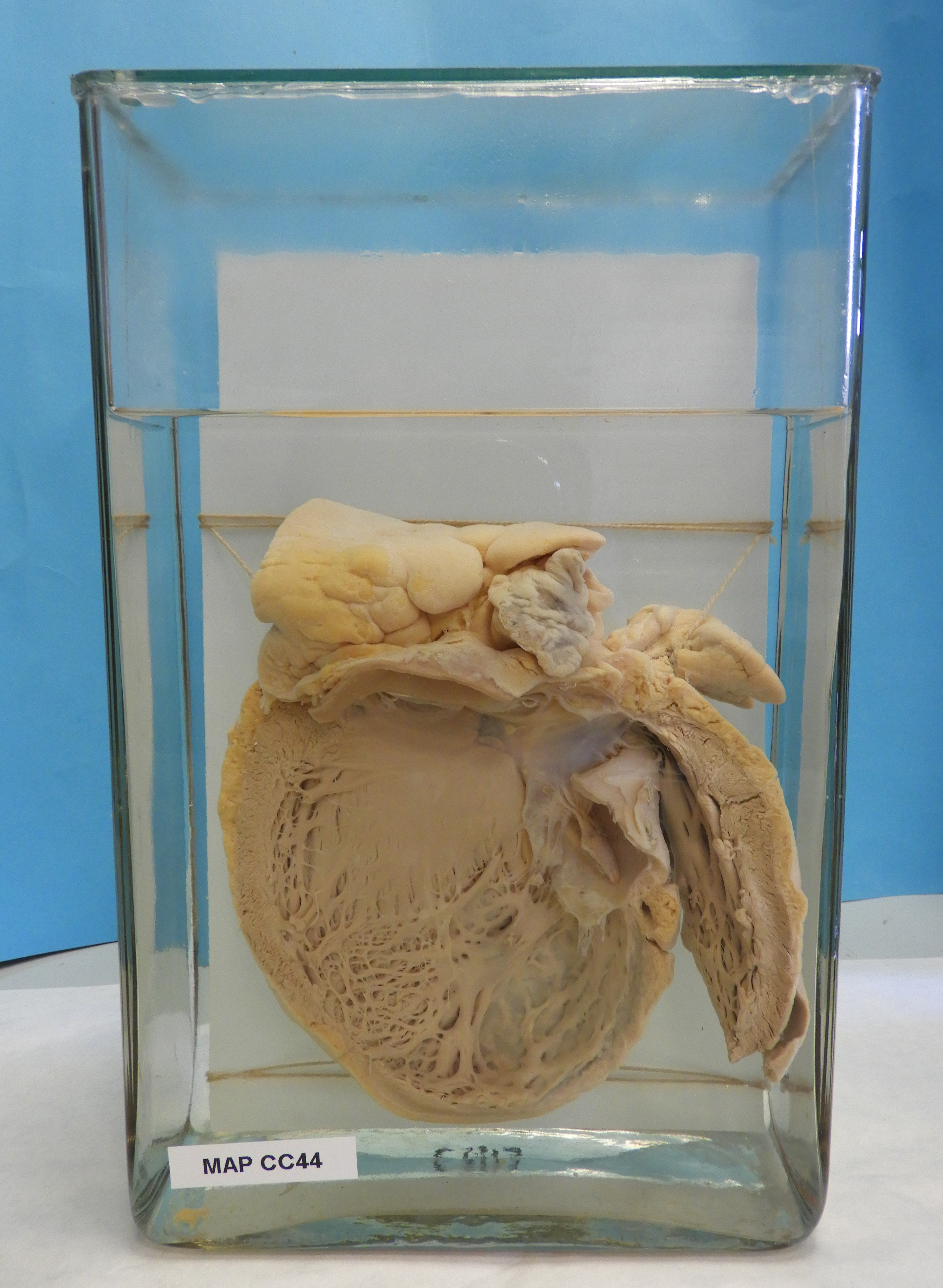 preparato anatomico, apparato cardiocircolatorio (morfologia naturale) (SECOLI/ XX)