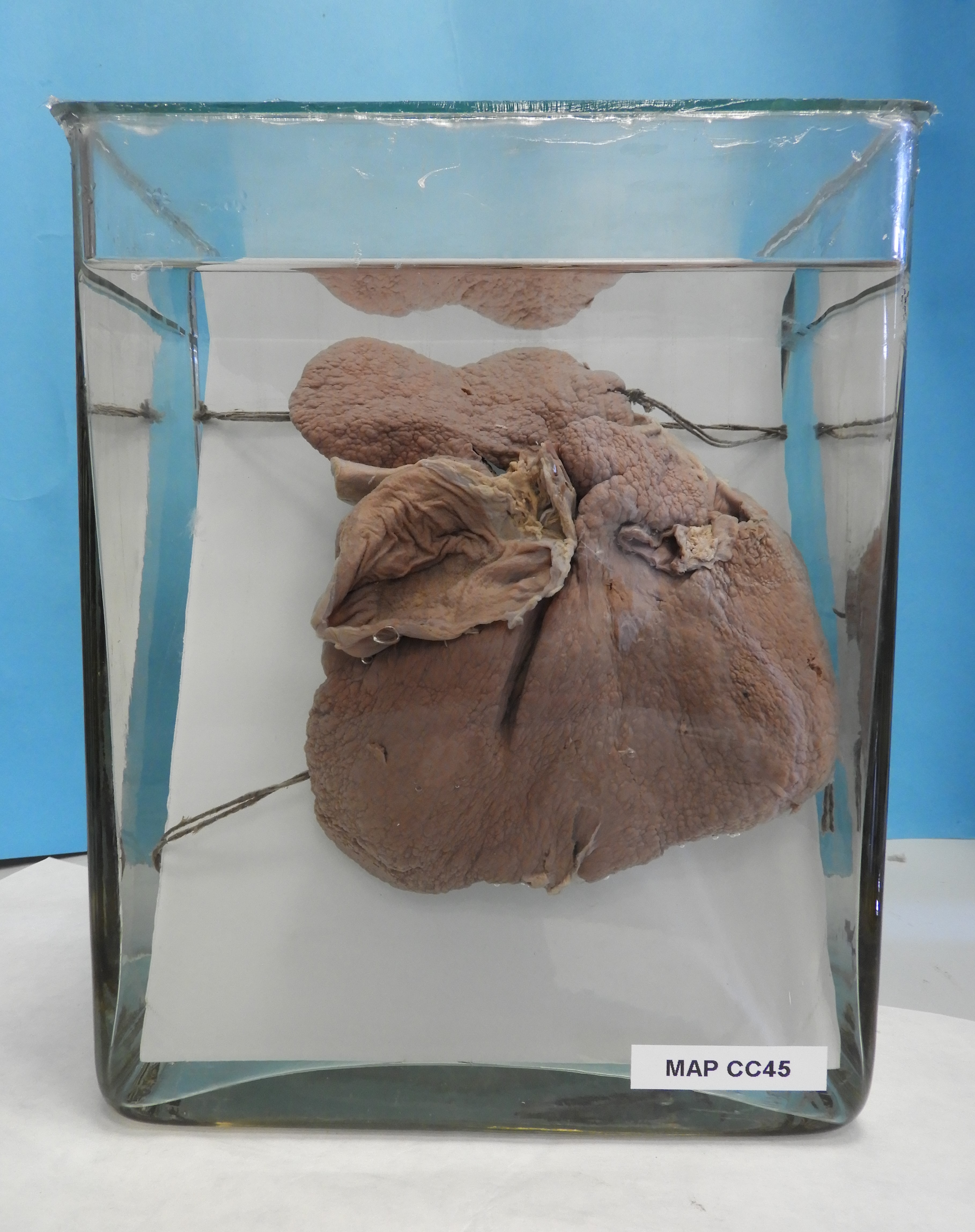 preparato anatomico, apparato cardiocircolatorio (morfologia naturale) (SECOLI/ XX)