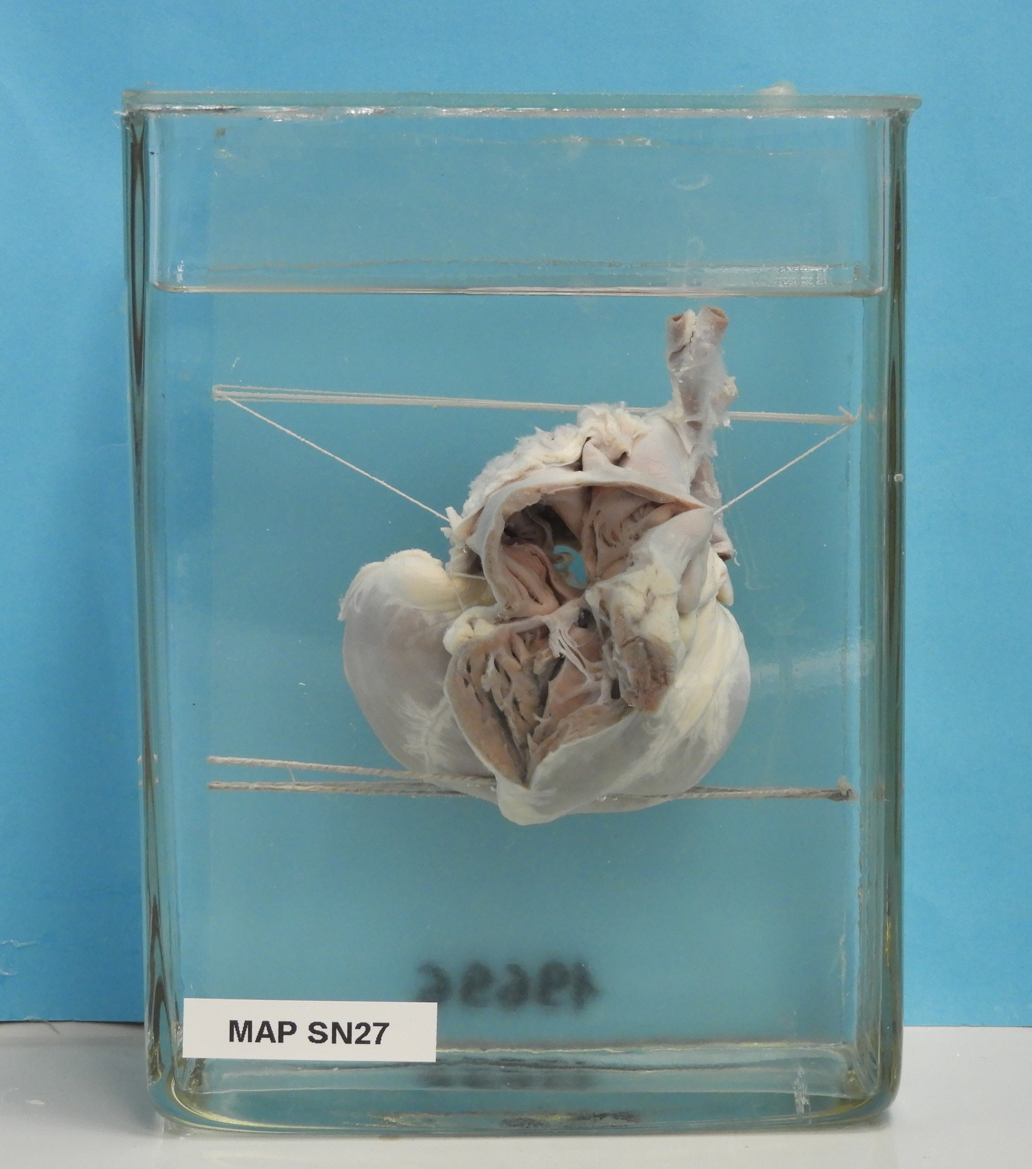 preparato anatomico, apparato cardiocircolatorio (morfologia naturale) (SECOLI/ XX)