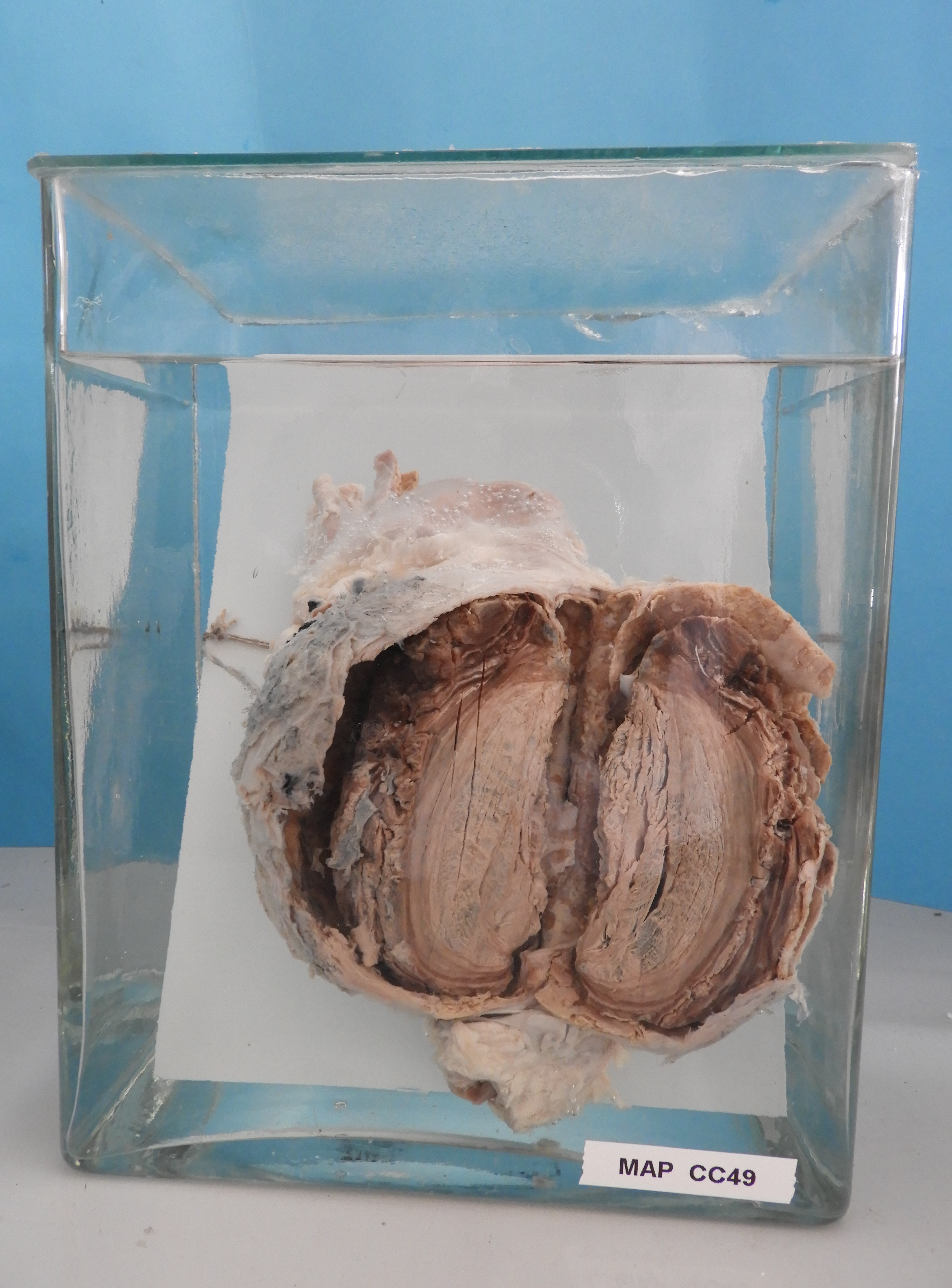 preparato anatomico, apparato cardiocircolatorio (morfologia naturale) (SECOLI/ XX)