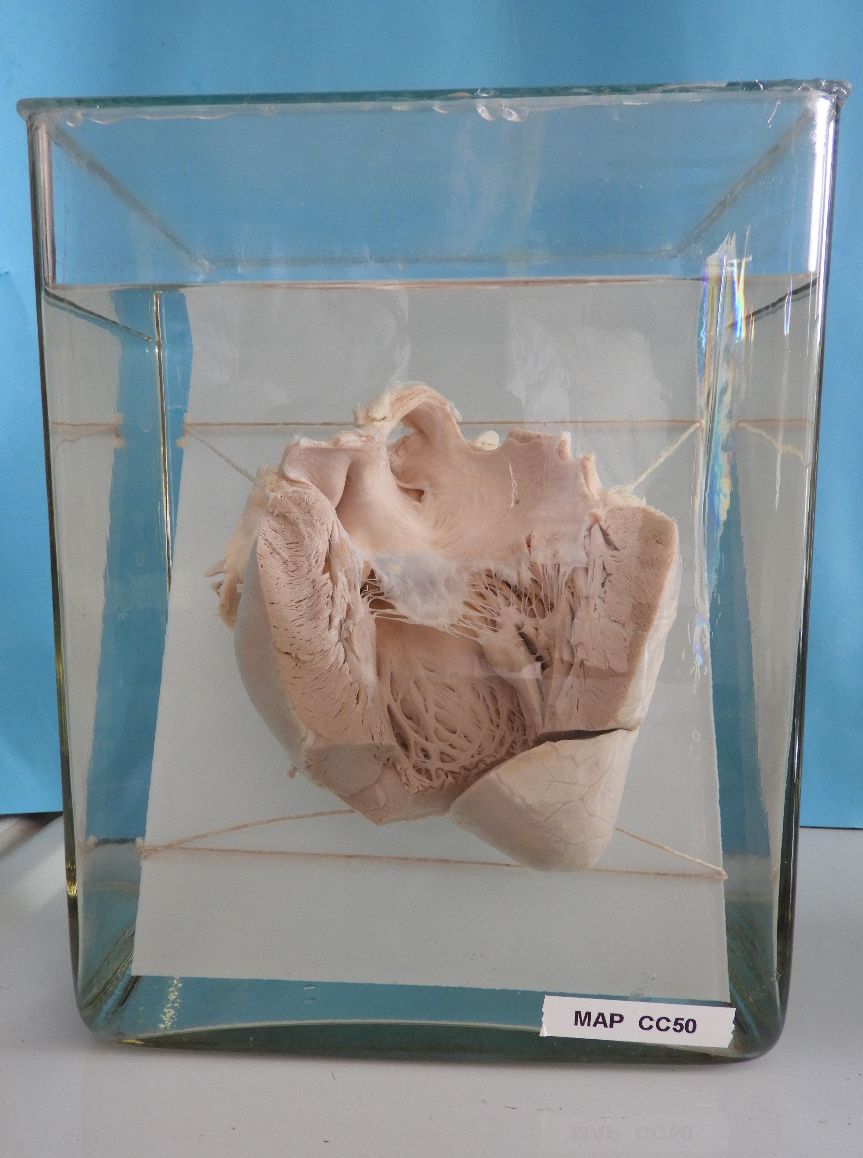 preparato anatomico, apparato cardiocircolatorio (morfologia naturale) (SECOLI/ XX)