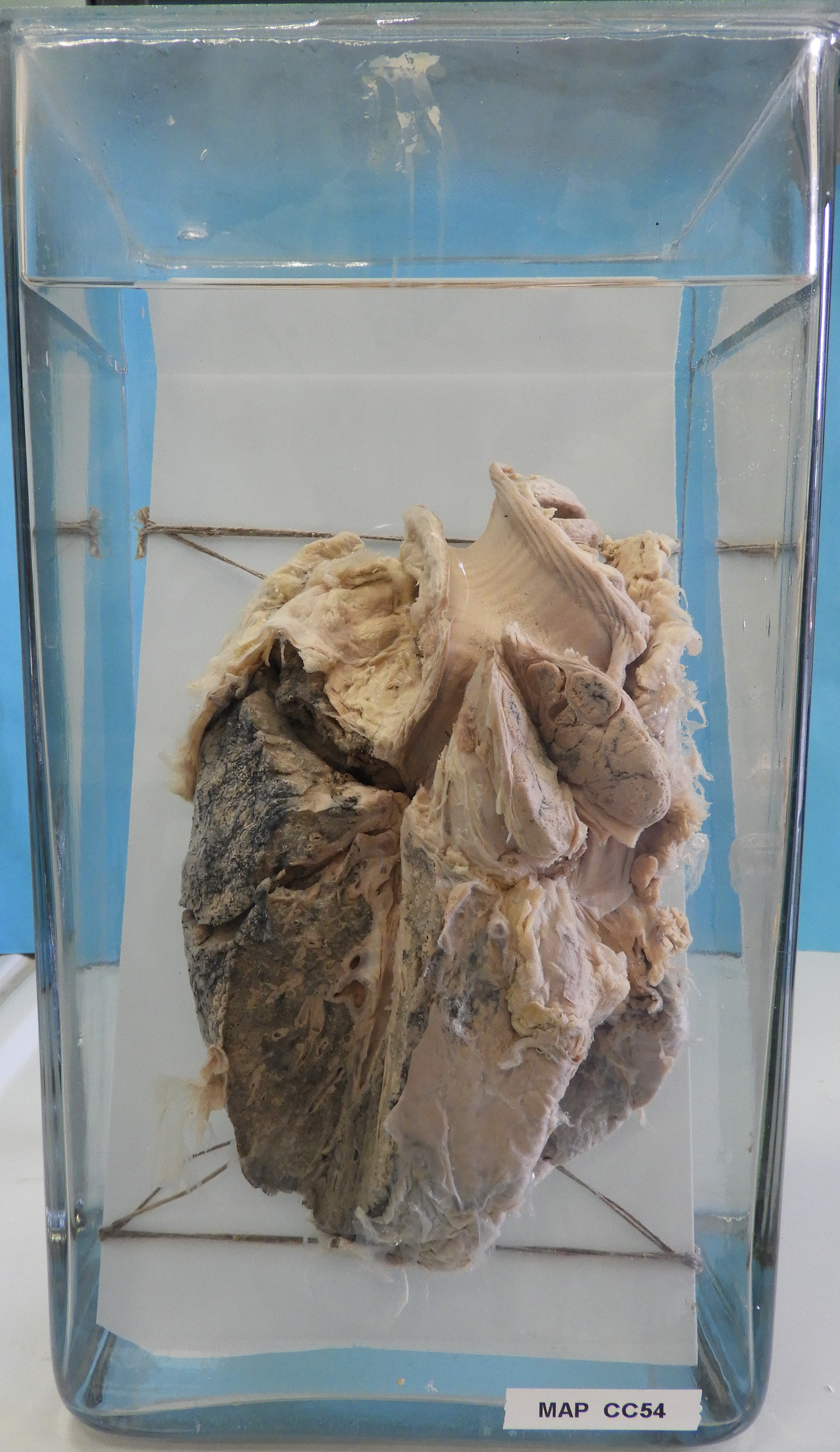 preparato anatomico, apparato respiratorio (morfologia naturale) (SECOLI/ XX)