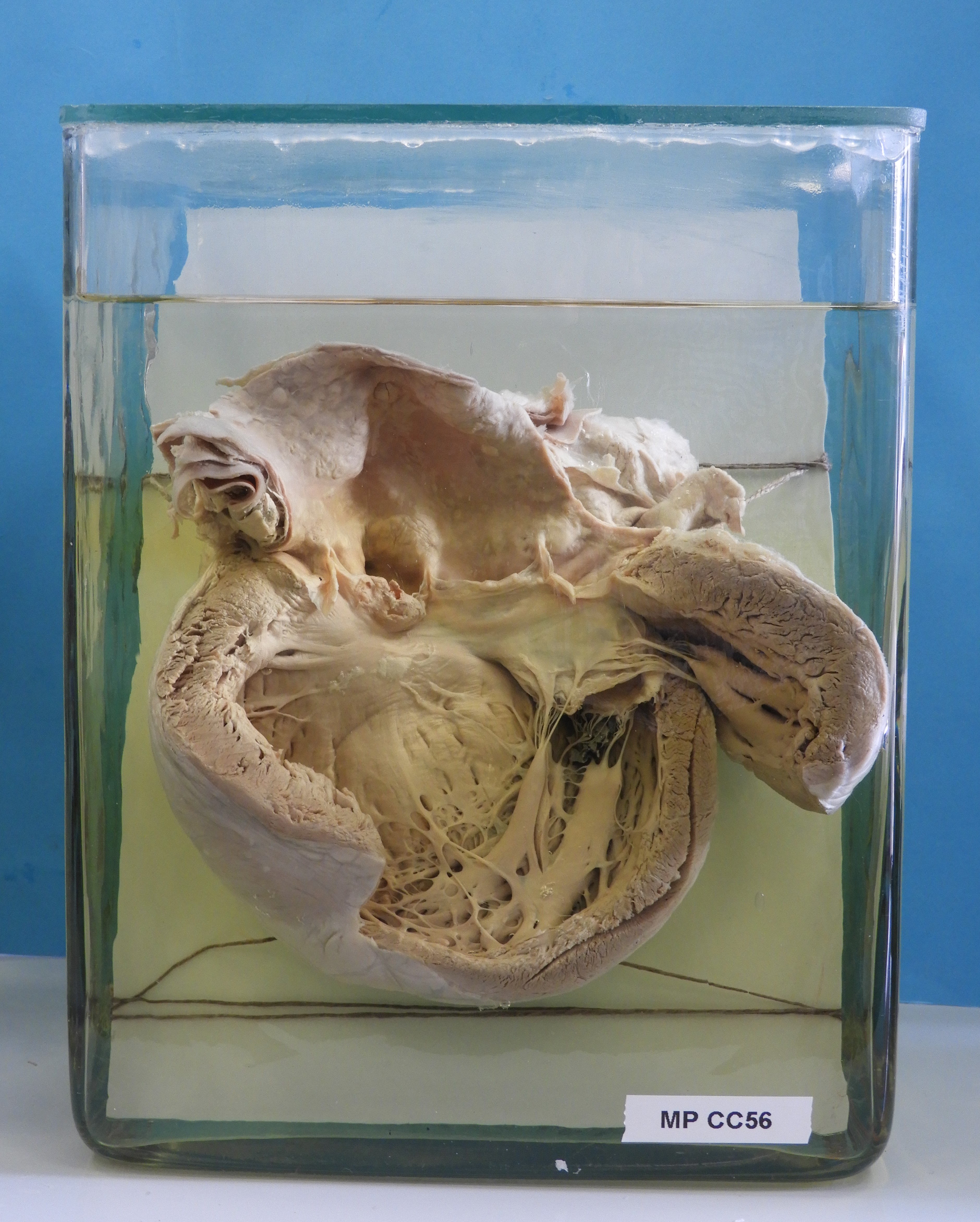 preparato anatomico, apparato cardiocircolatorio (morfologia naturale) (SECOLI/ XX)