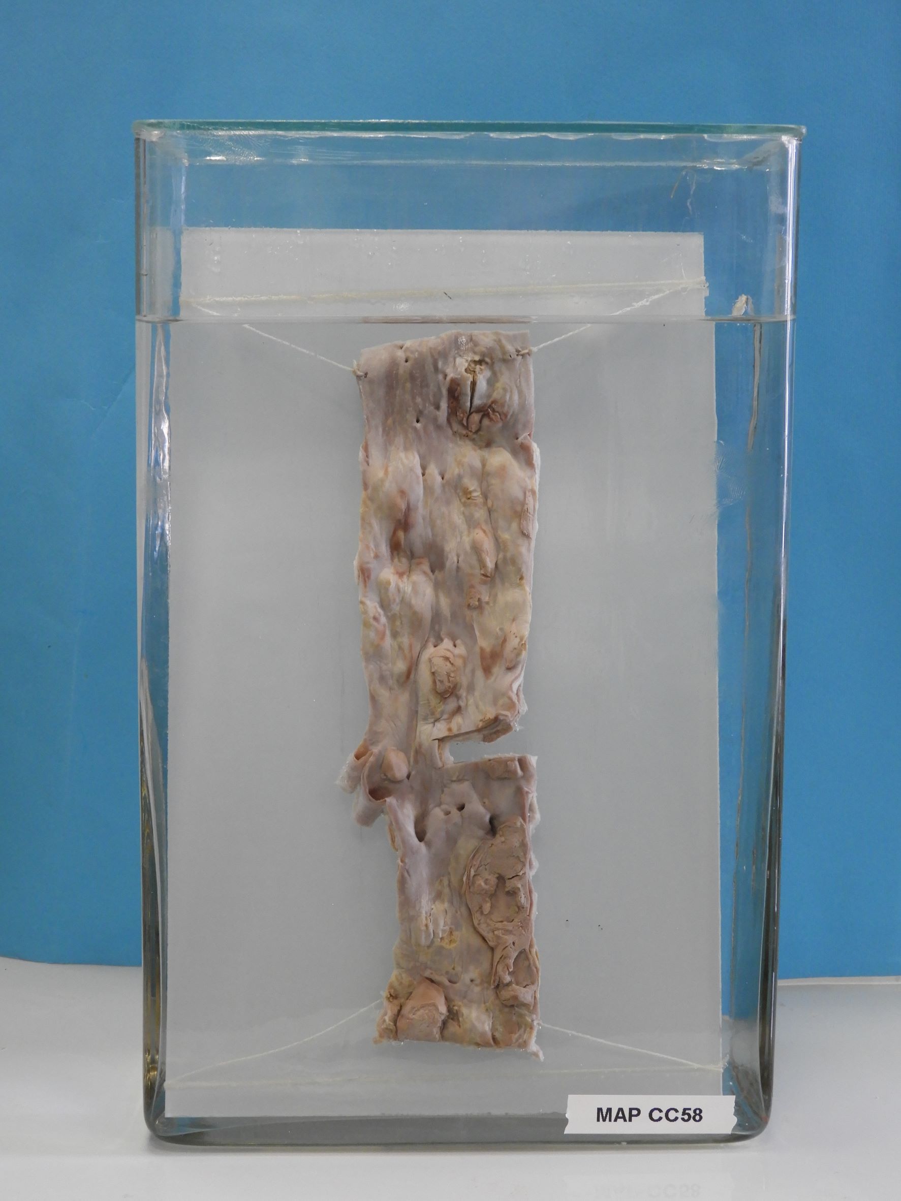 preparato anatomico, apparato cardiocircolatorio (morfologia naturale) (SECOLI/ XX)