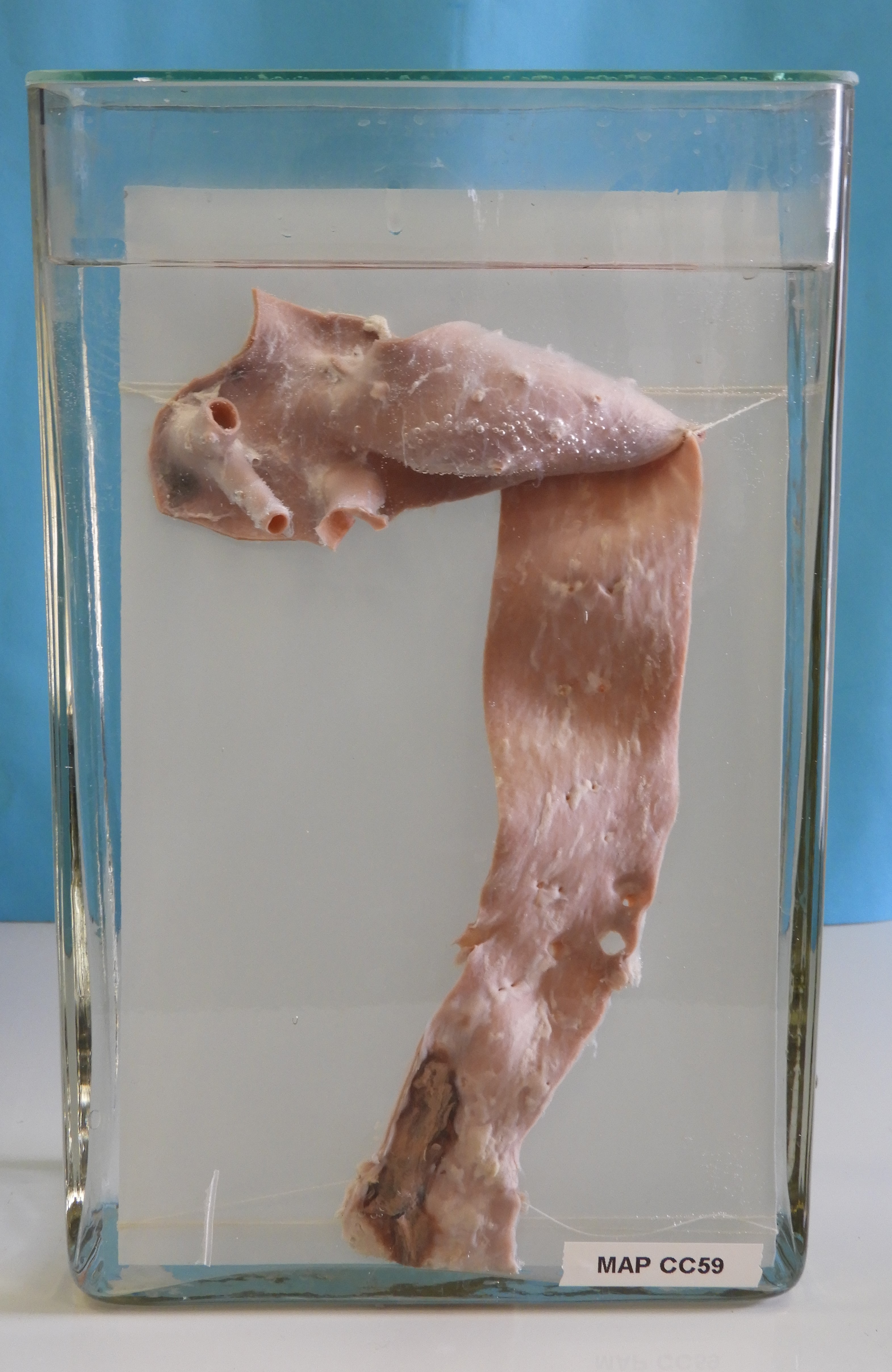 preparato anatomico, apparato cardiocircolatorio (morfologia naturale) (SECOLI/ XX)