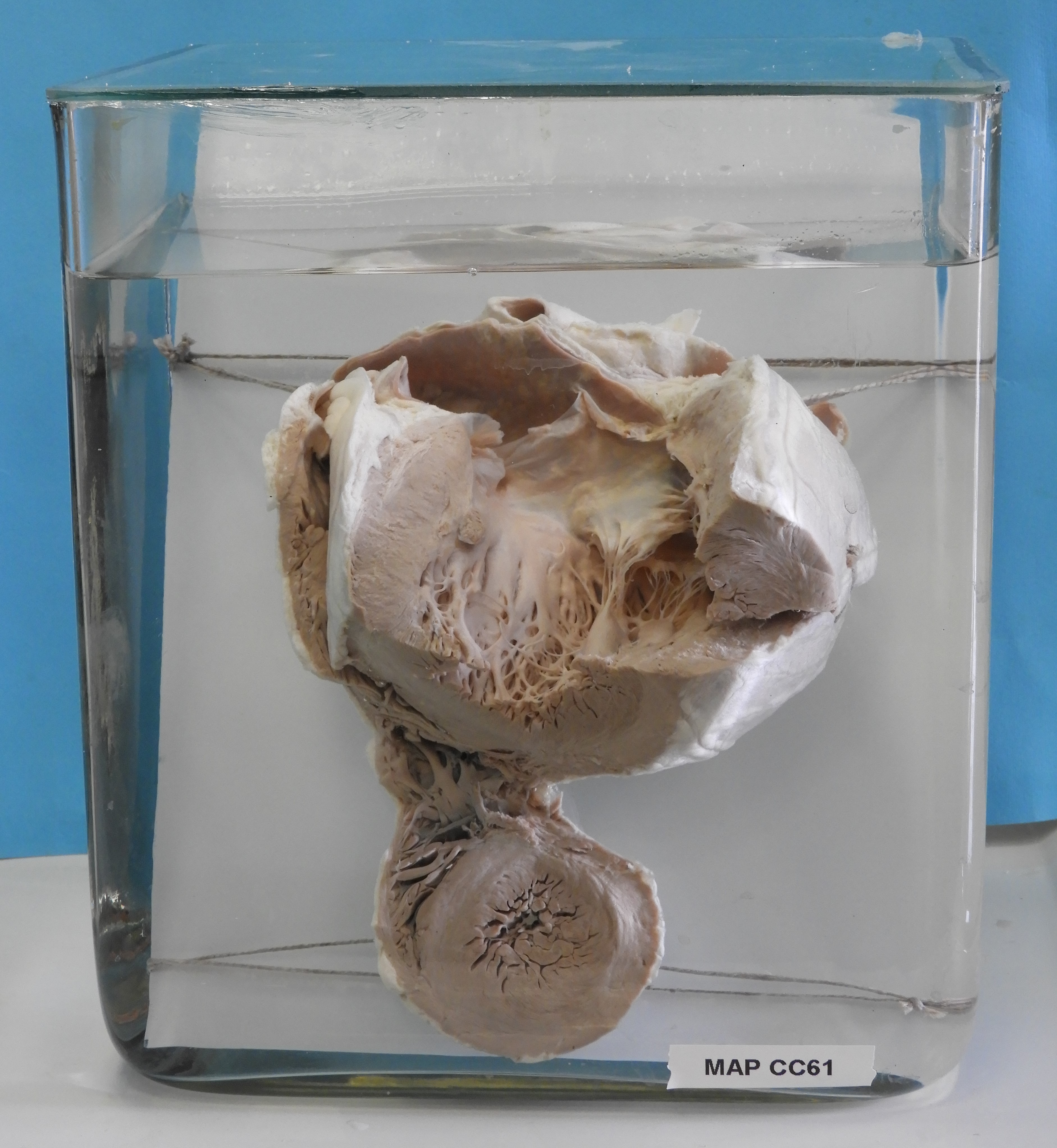 preparato anatomico, apparato cardiocircolatorio (morfologia naturale) (SECOLI/ XX)