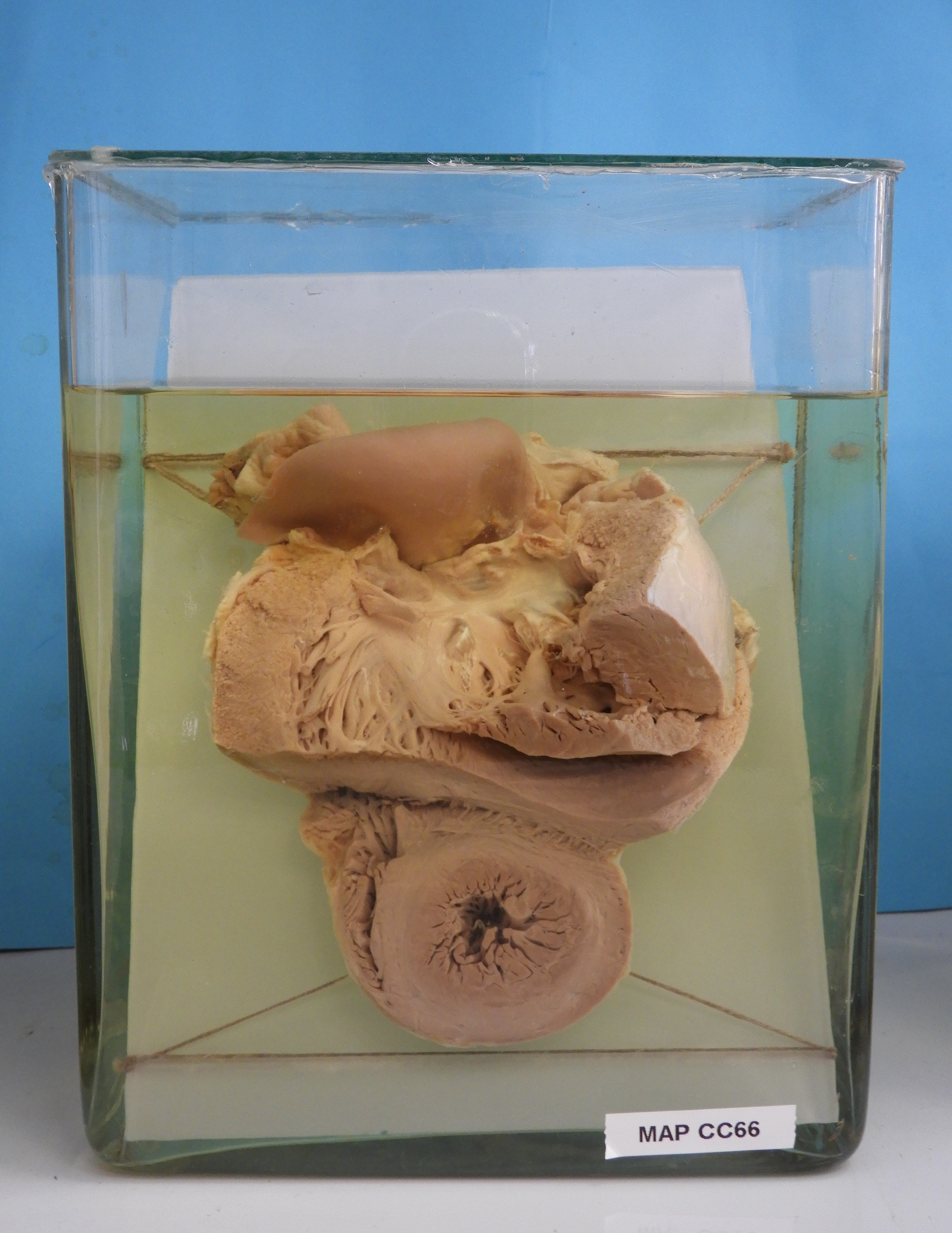 preparato anatomico, apparato cardiocircolatorio (morfologia naturale) (SECOLI/ XX)