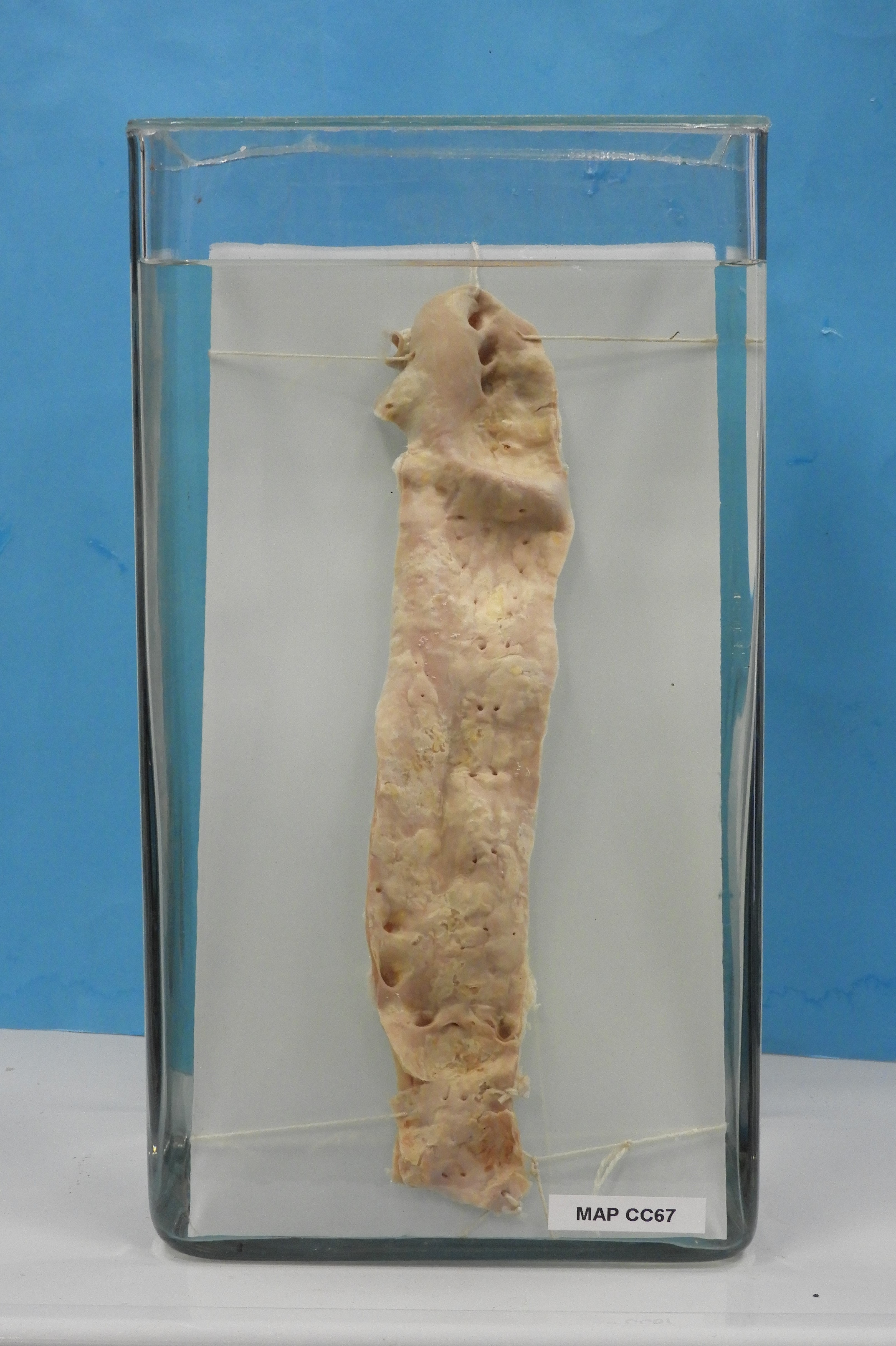 preparato anatomico, apparato cardiocircolatorio (morfologia naturale) (SECOLI/ XX)