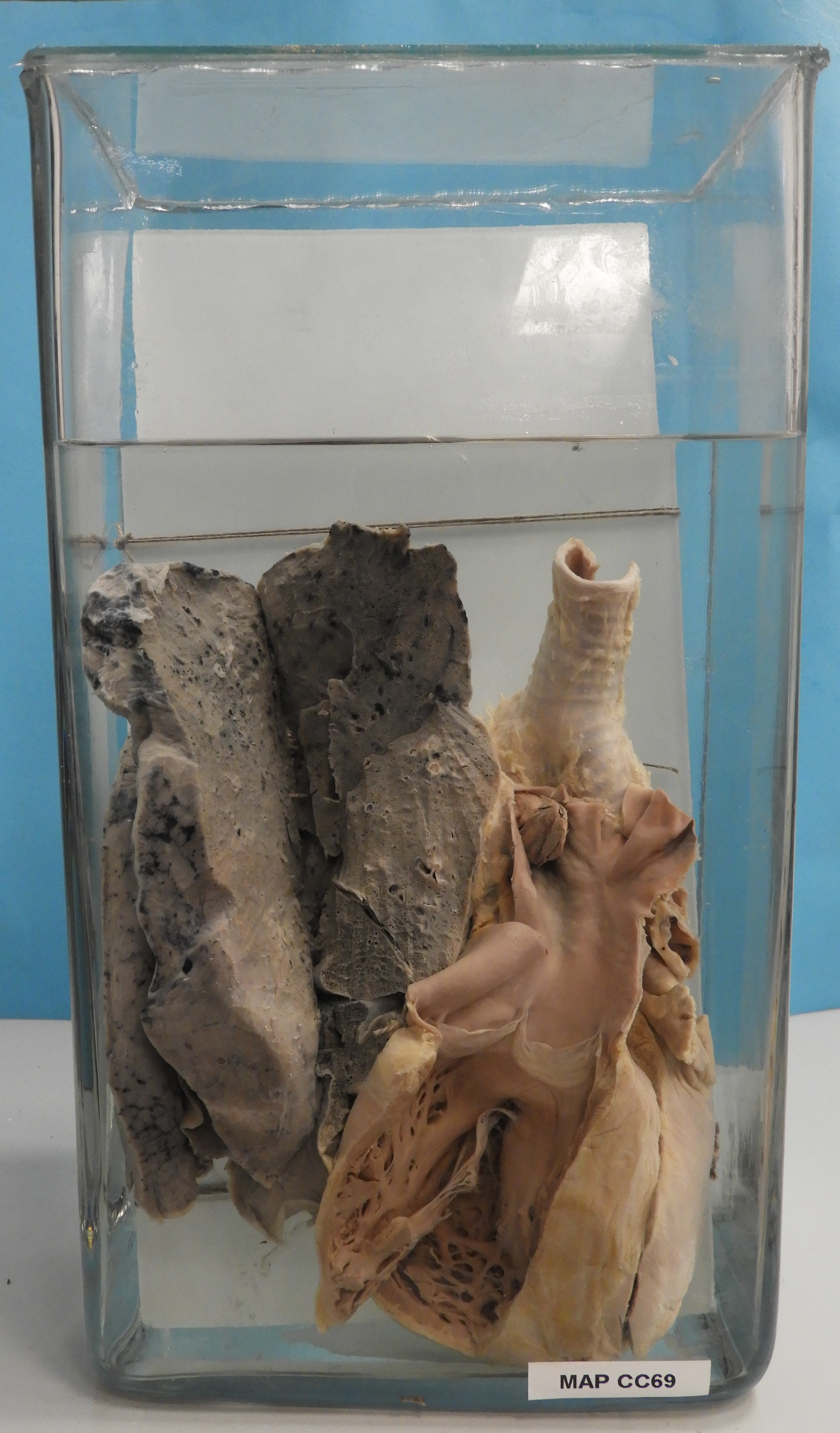 preparato anatomico, apparato cardiocircolatorio (morfologia naturale) (SECOLI/ XX)