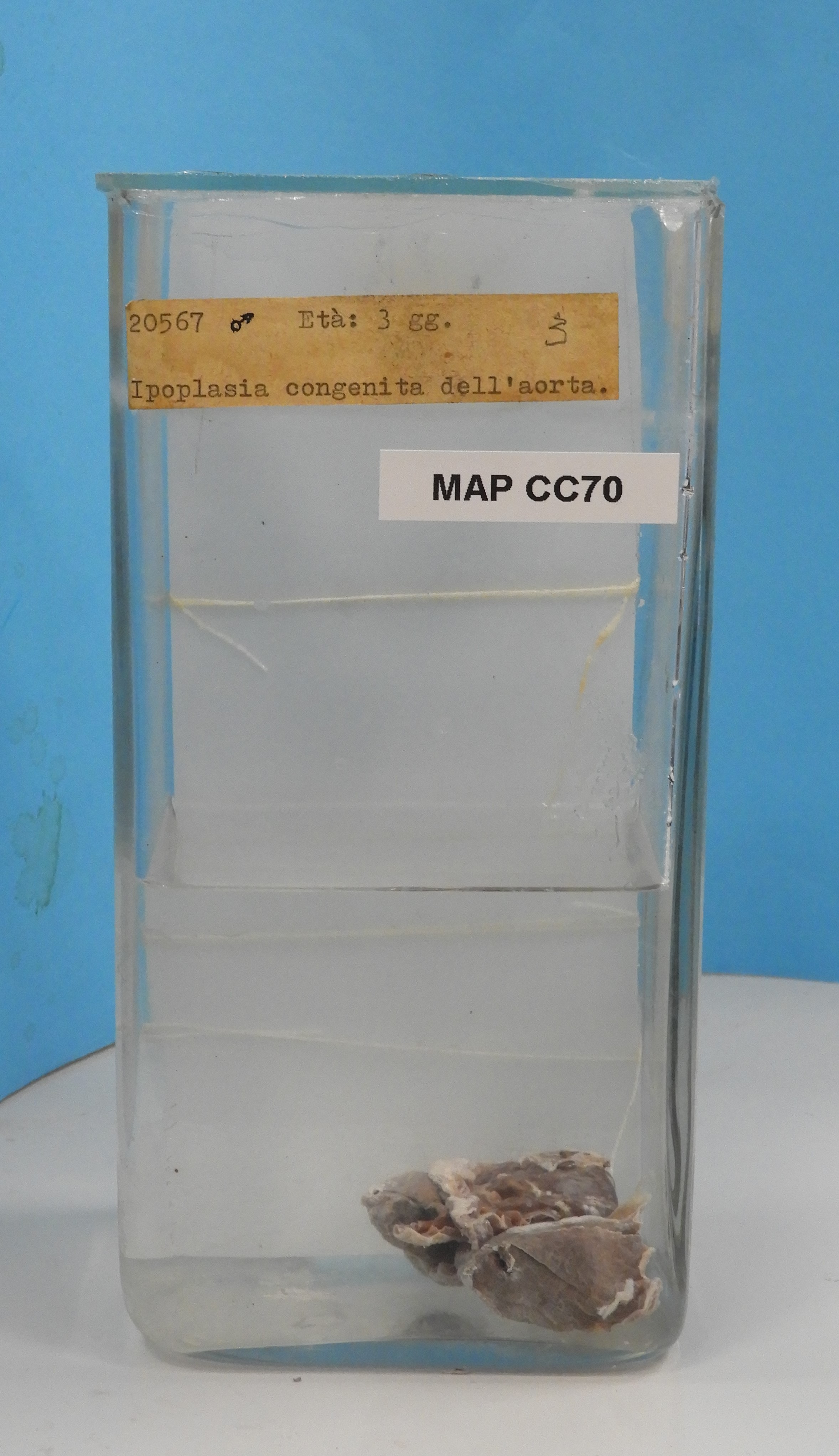 preparato anatomico, apparato cardiocircolatorio (morfologia naturale) (SECOLI/ XX)