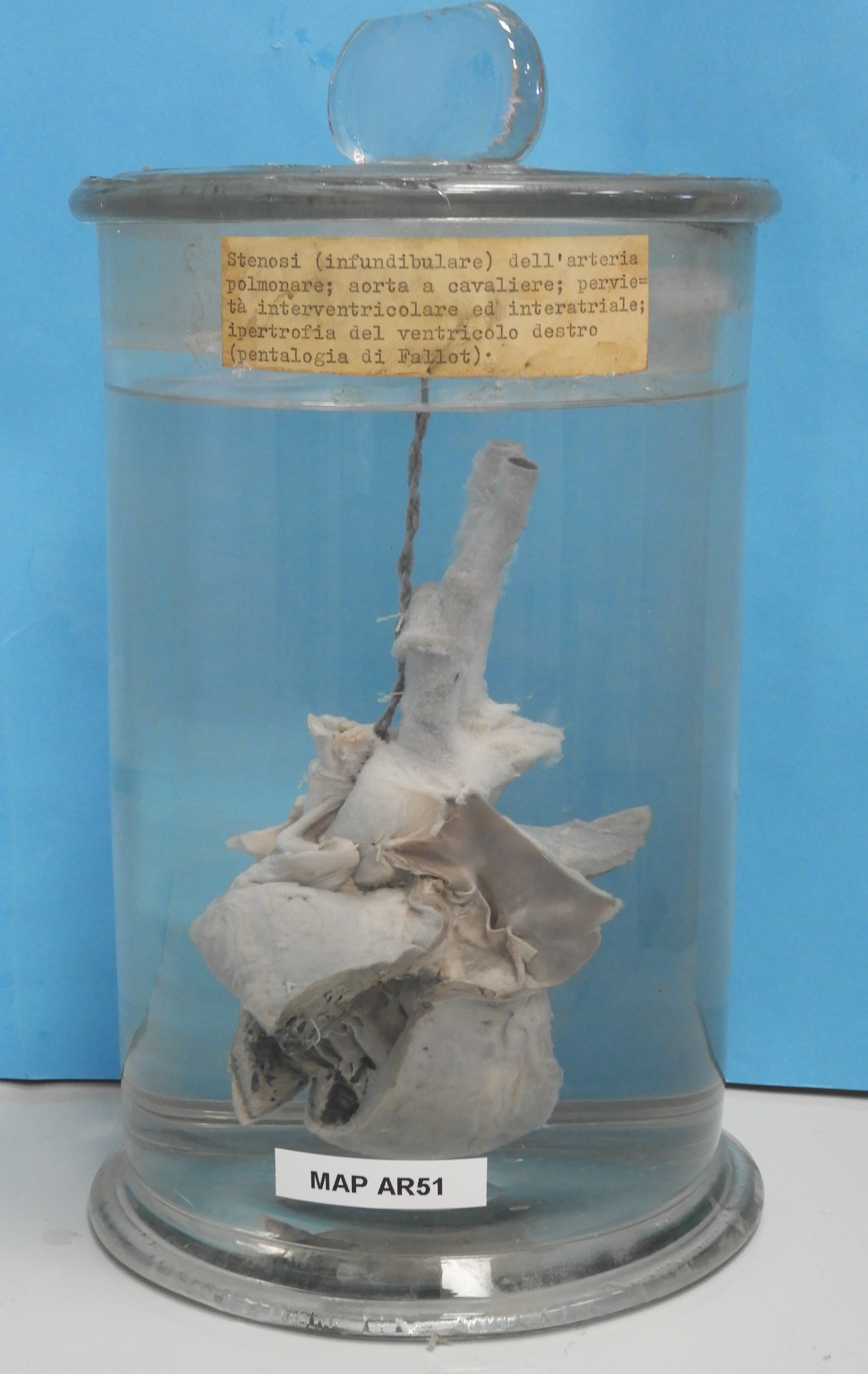 preparato anatomico, apparato cardiocircolatorio (morfologia naturale) (SECOLI/ XX)