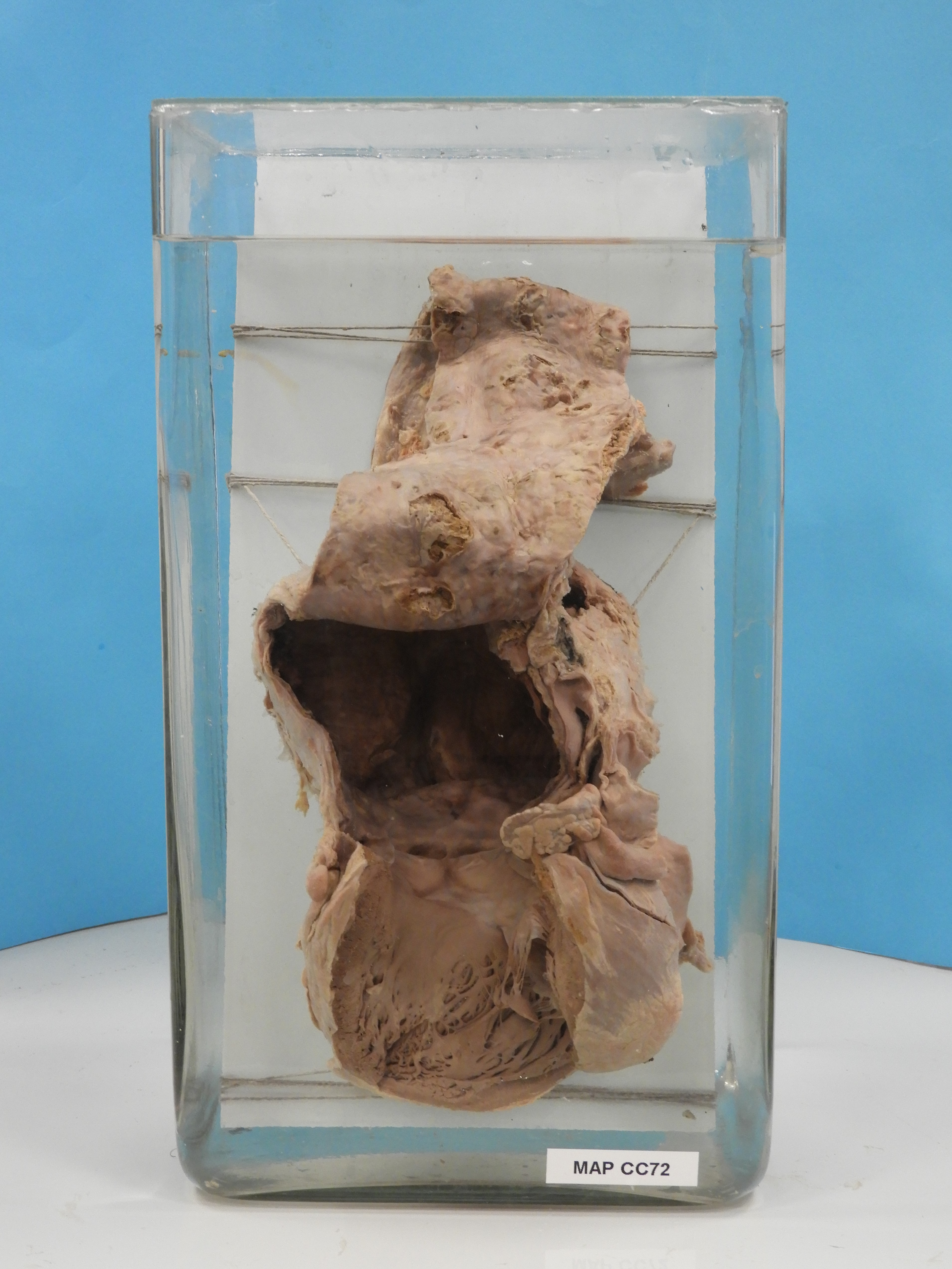 preparato anatomico, apparato cardiocircolatorio (morfologia naturale) (SECOLI/ XX)