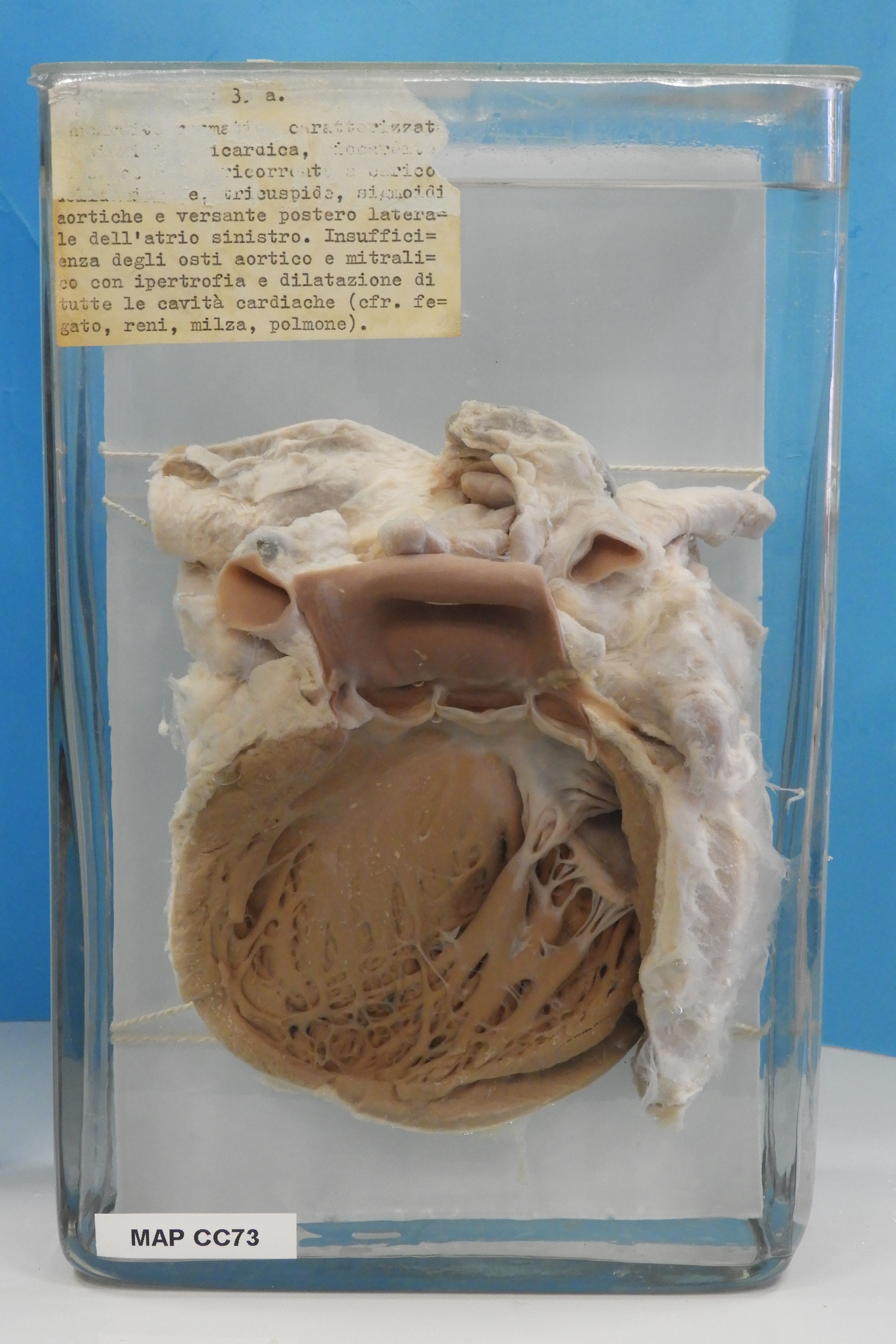 preparato anatomico, apparato cardiocircolatorio (morfologia naturale) (SECOLI/ XX)