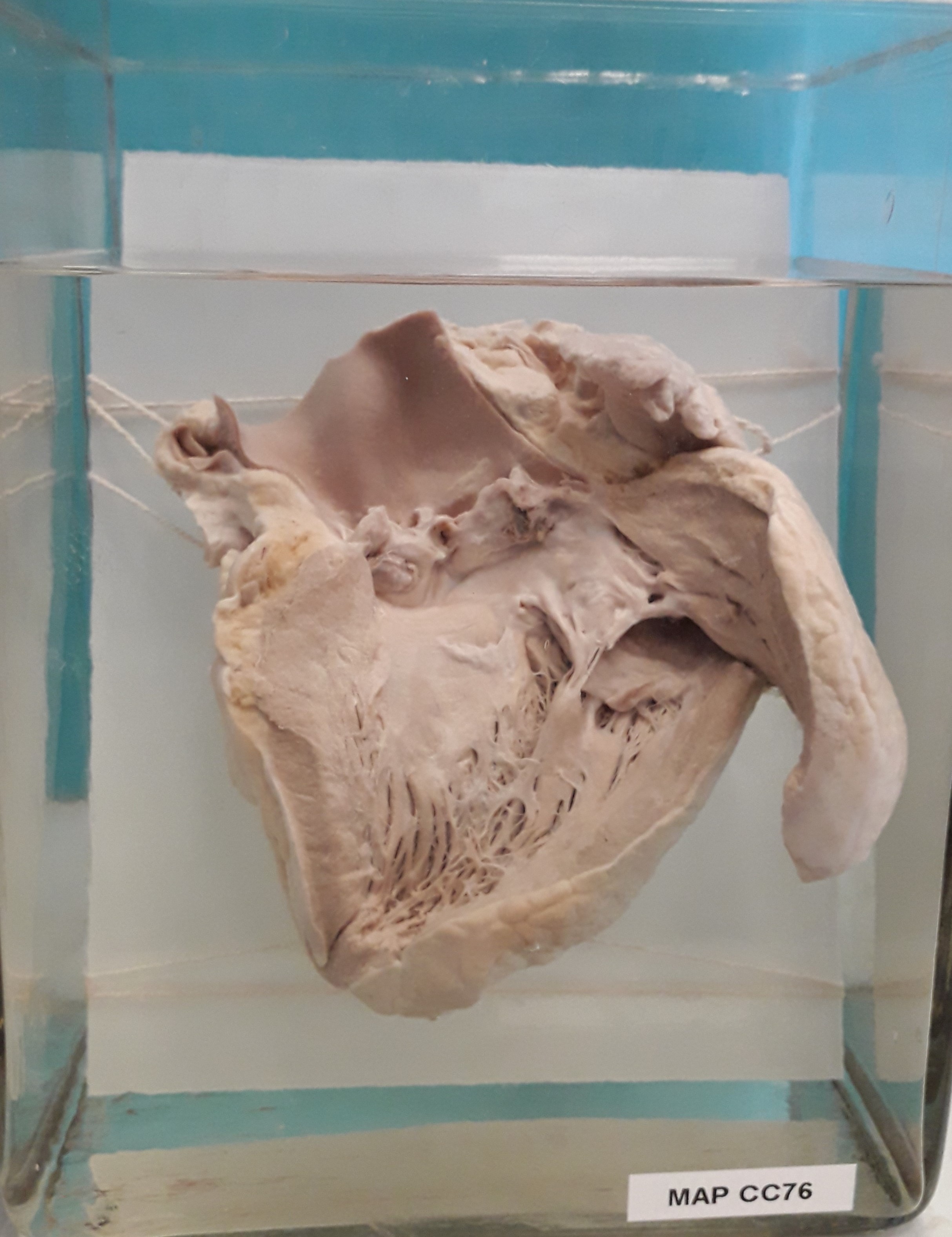 preparato anatomico, apparato cardiocircolatorio (morfologia naturale) (SECOLI/ XX)