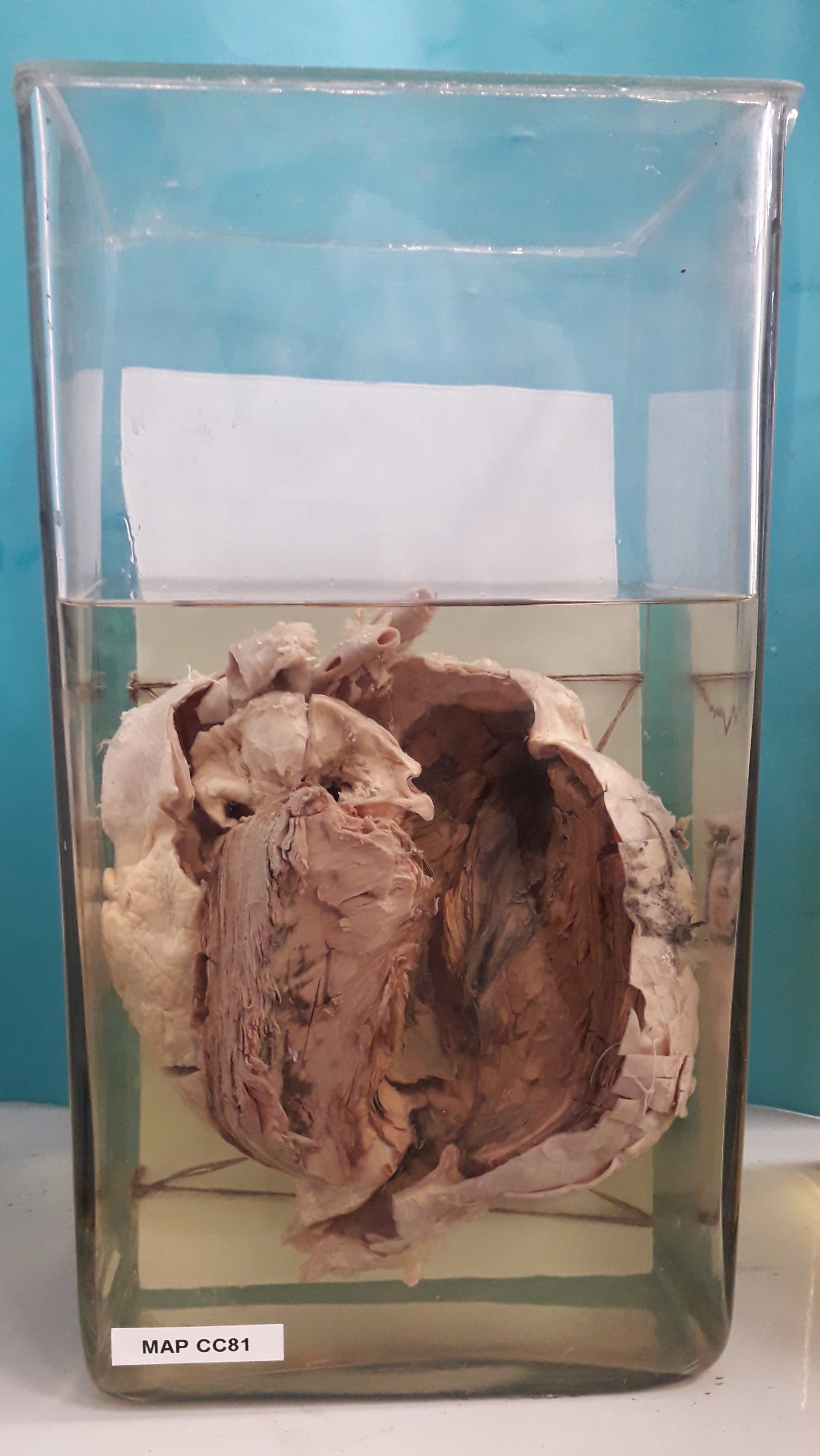 preparato anatomico, apparato cardiocircolatorio (morfologia naturale) (SECOLI/ XX)