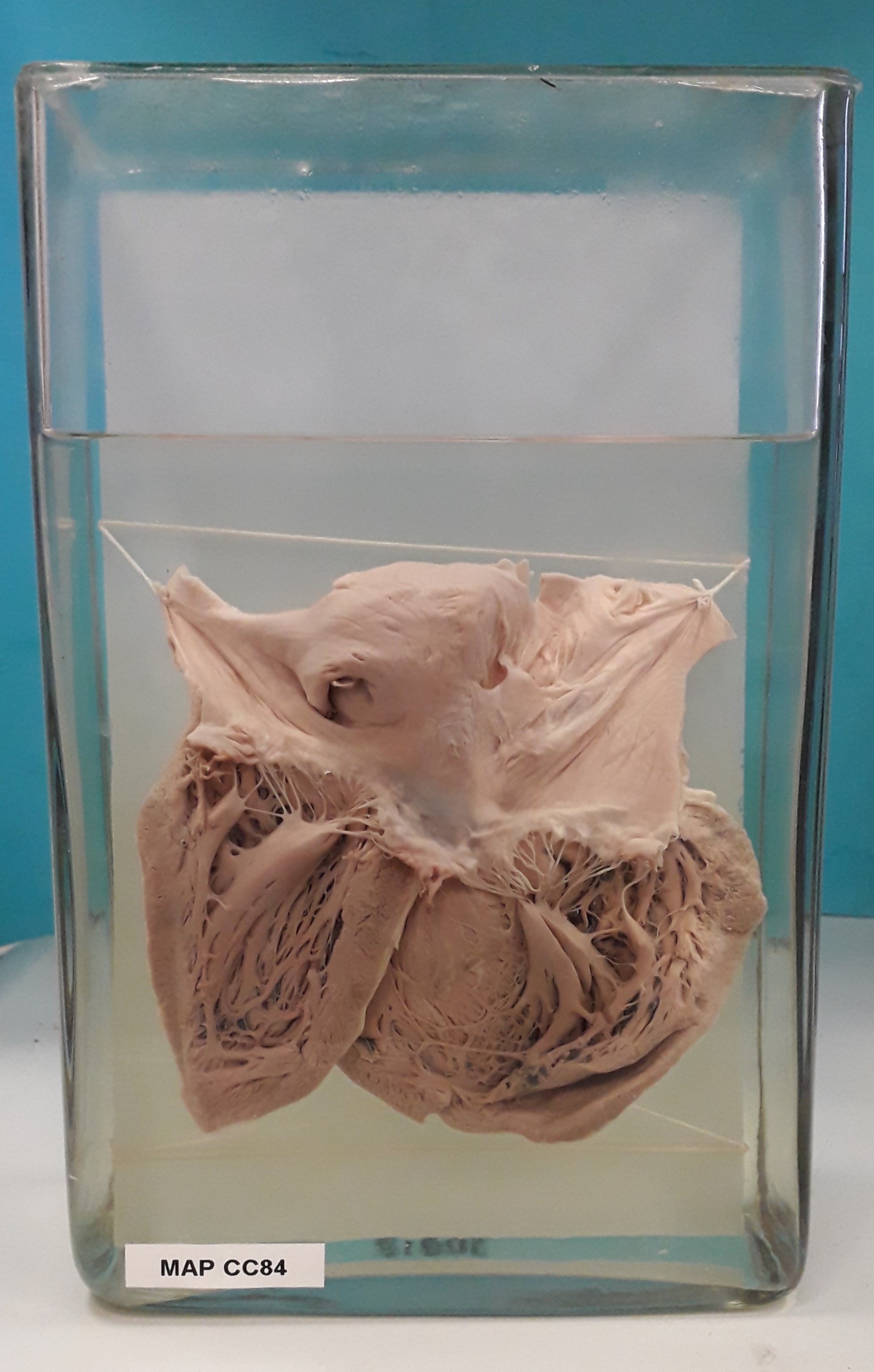 preparato anatomico, apparato cardiocircolatorio (morfologia naturale) (SECOLI/ XX)