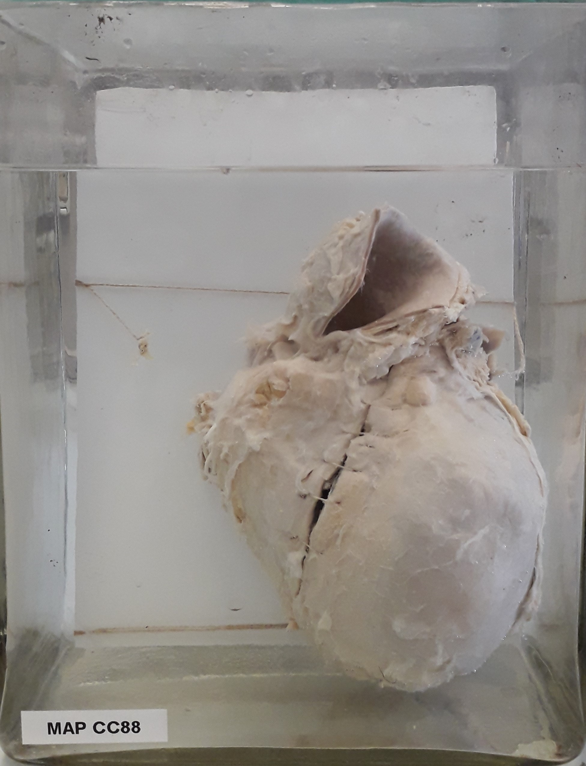 preparato anatomico, apparato cardiocircolatorio (morfologia naturale) (SECOLI/ XX)