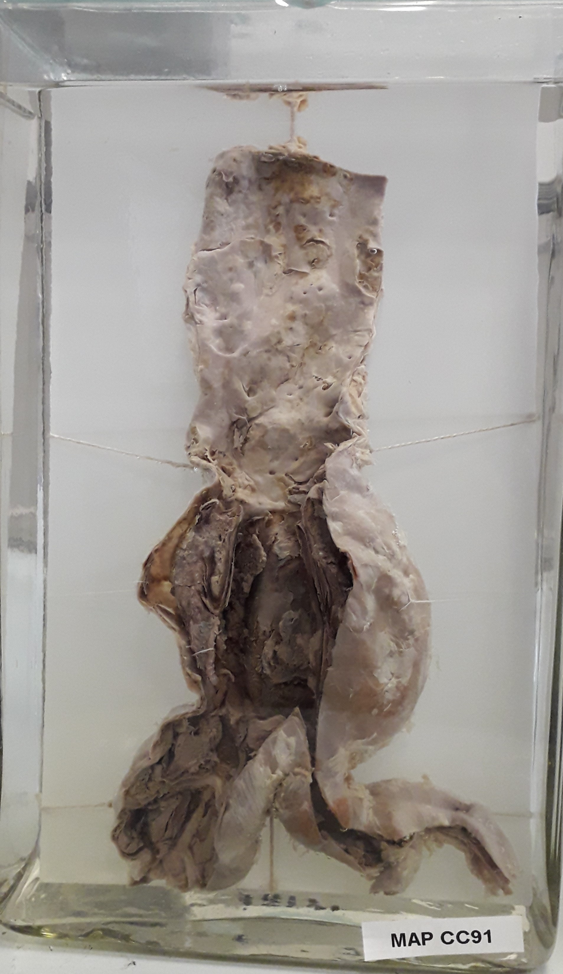 preparato anatomico, apparato cardiocircolatorio (morfologia naturale) (SECOLI/ XX)