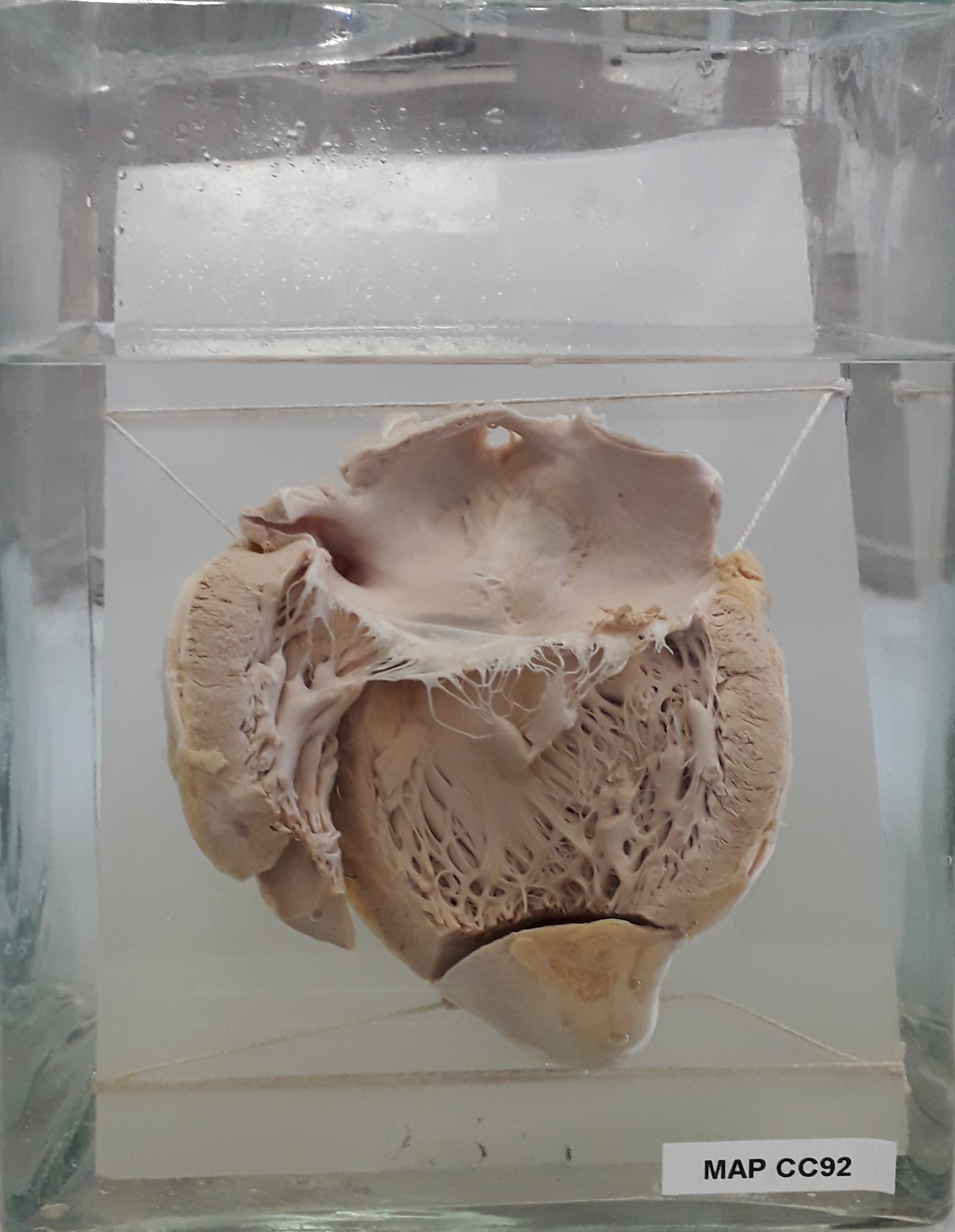 preparato anatomico, apparato cardiocircolatorio (morfologia naturale) (SECOLI/ XX)