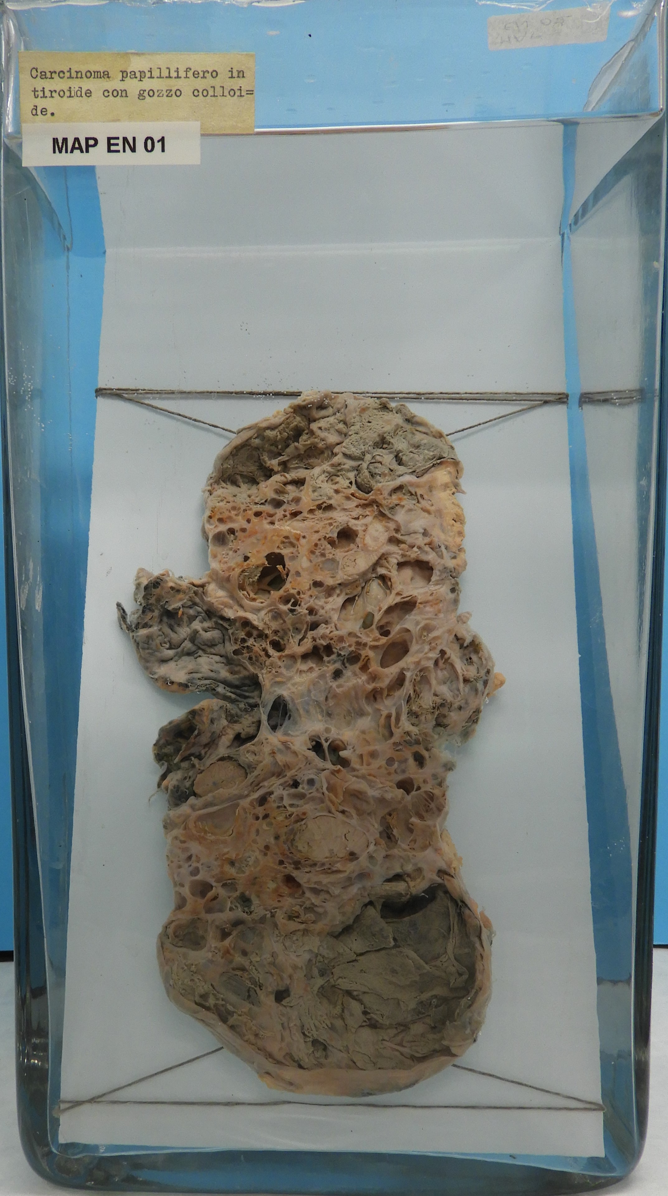 preparato anatomico, sistema endocrino (morfologia naturale) (SECOLI/ XX)