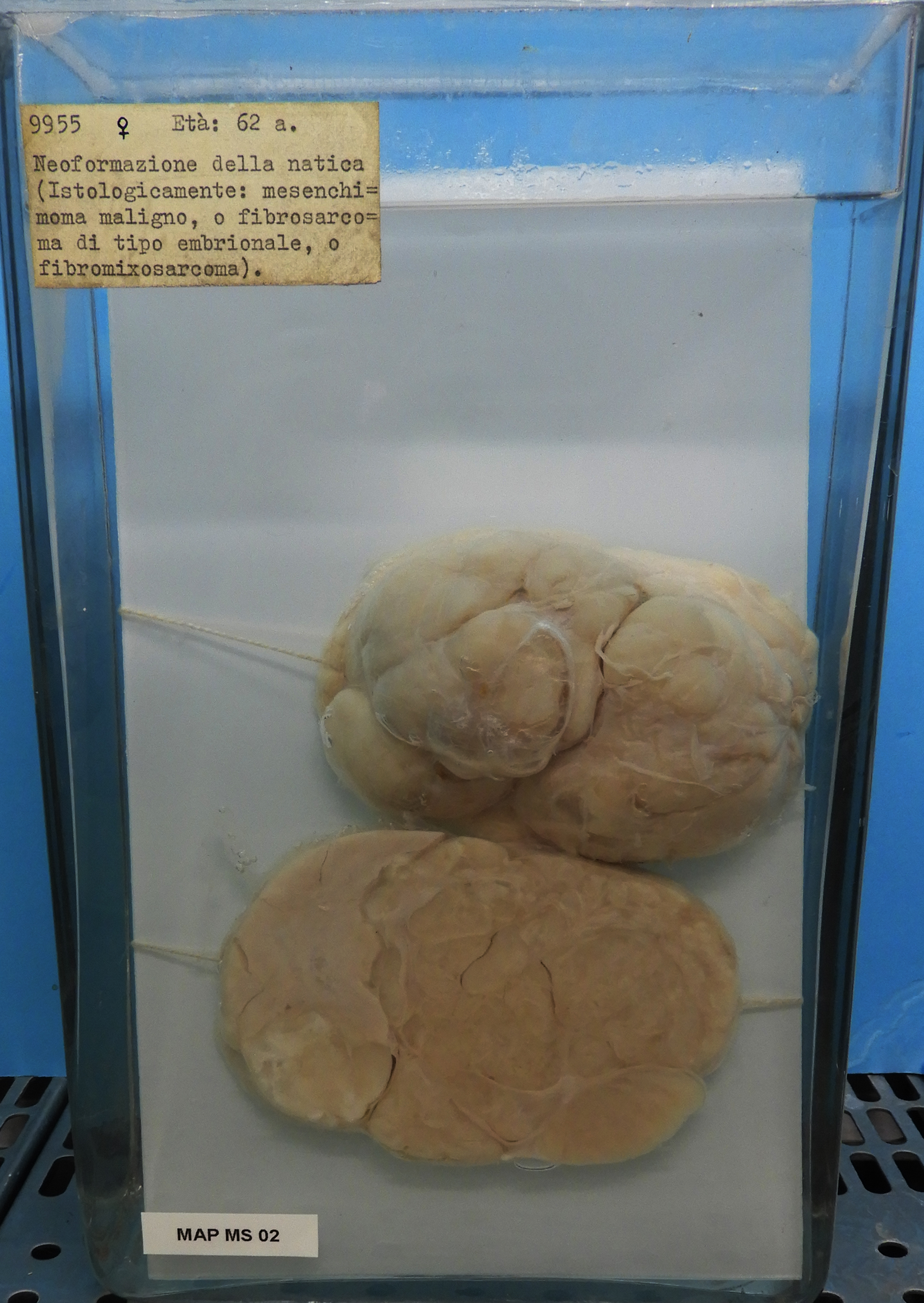 preparato anatomico, sistema muscolo-scheletrico (morfologia naturale) (SECOLI/ XX)