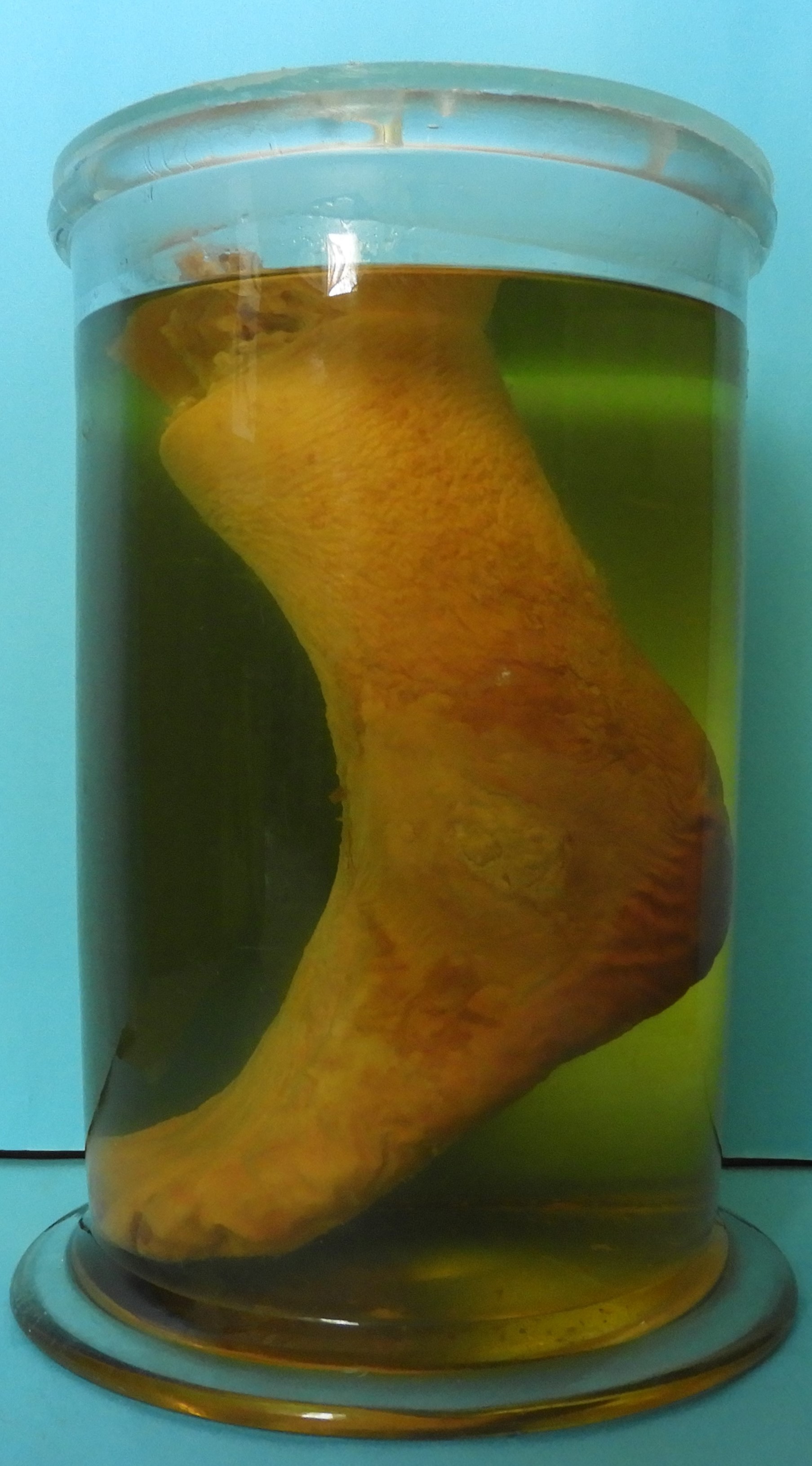 preparato anatomico, sistema muscolo-scheletrico (morfologia naturale) (SECOLI/ XX)