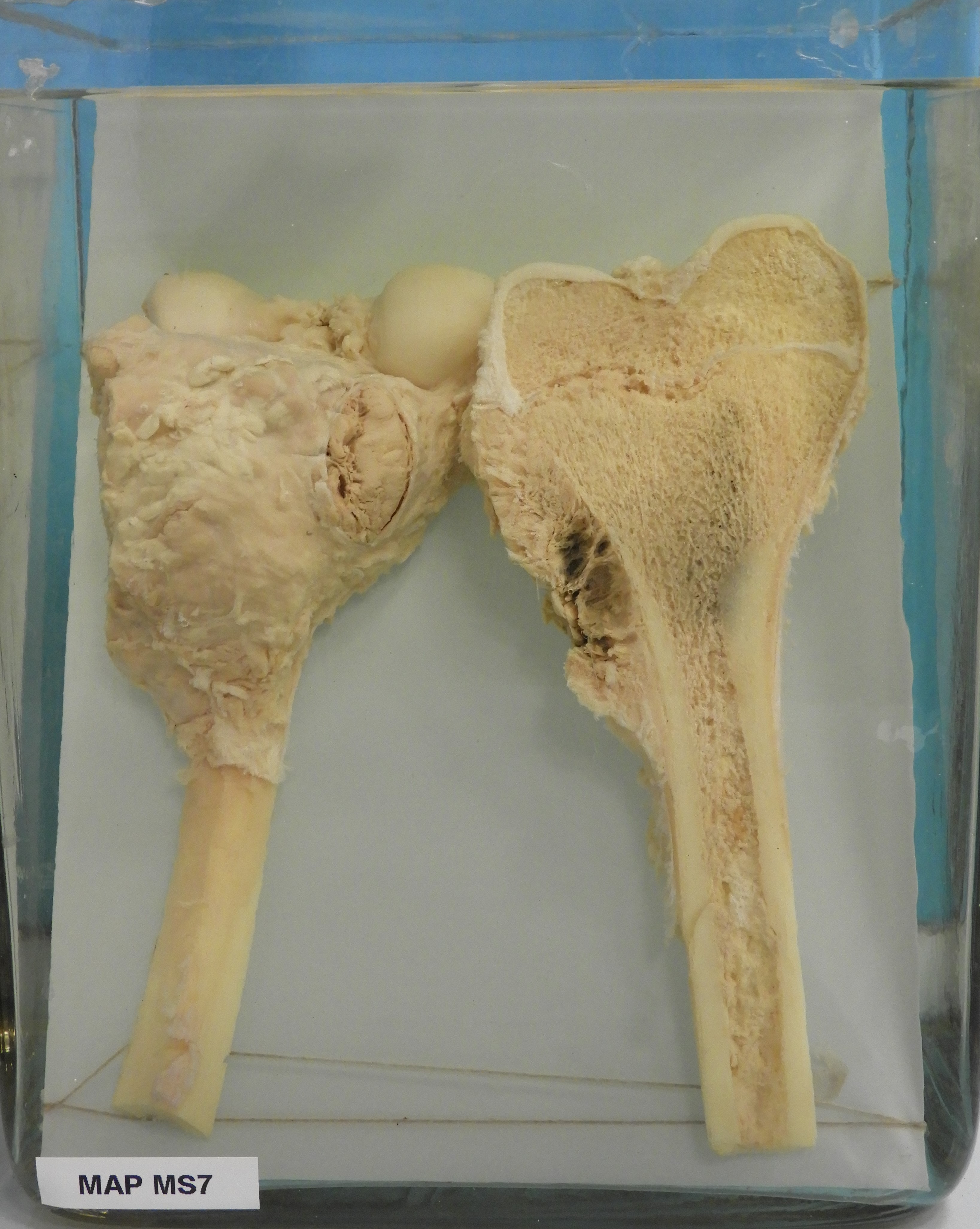 preparato anatomico, sistema muscolo-scheletrico (morfologia naturale) (SECOLI/ XX)