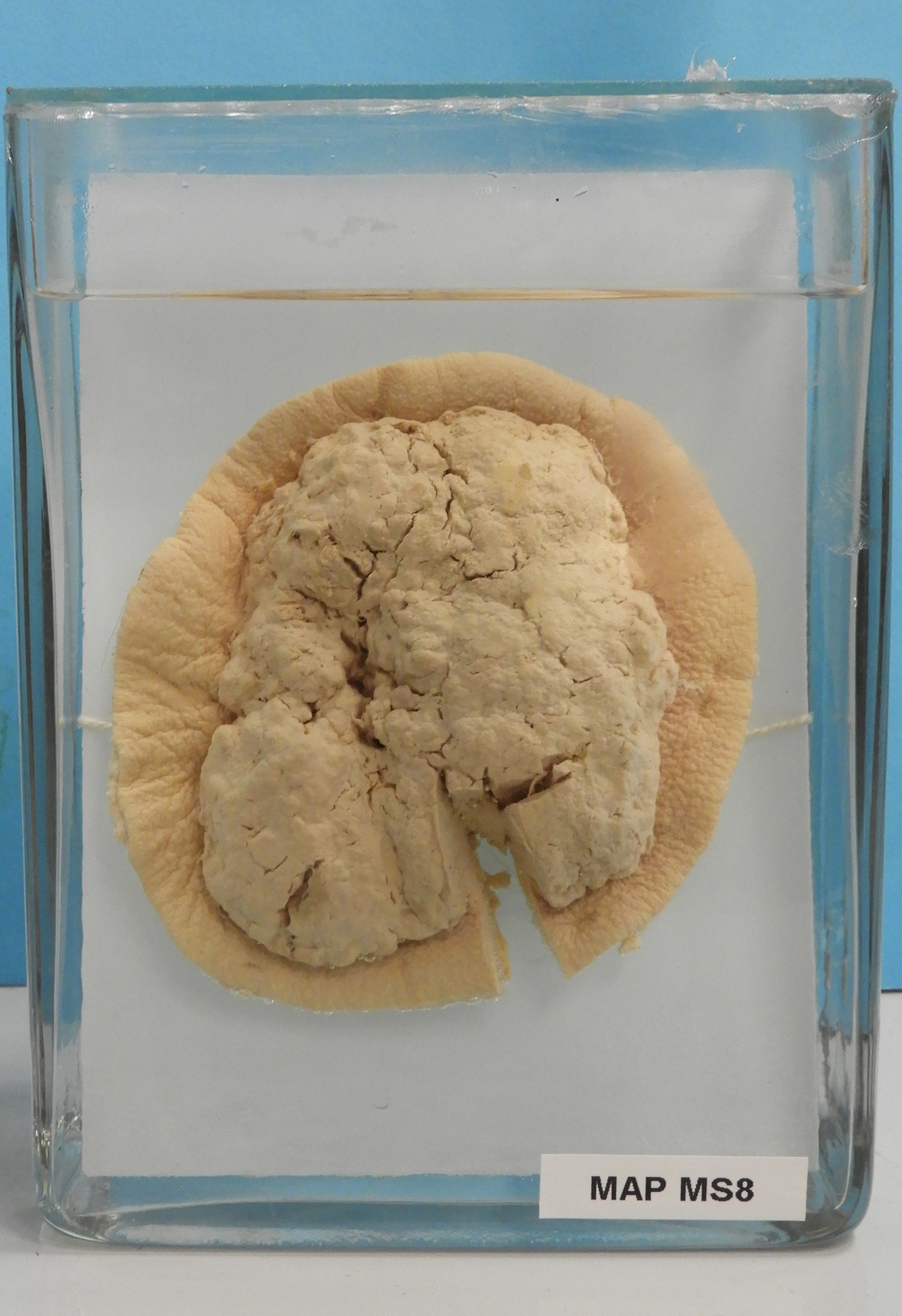 preparato anatomico, sistema muscolo-scheletrico (morfologia naturale) (SECOLI/ XX)