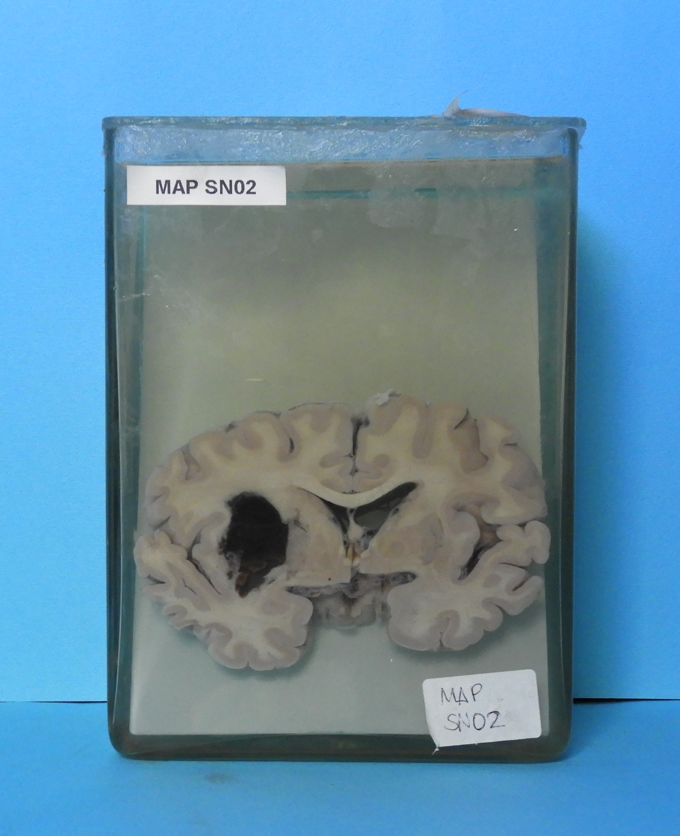 preparato anatomico, sistema nervoso (morfologia naturale) (SECOLI/ XX)