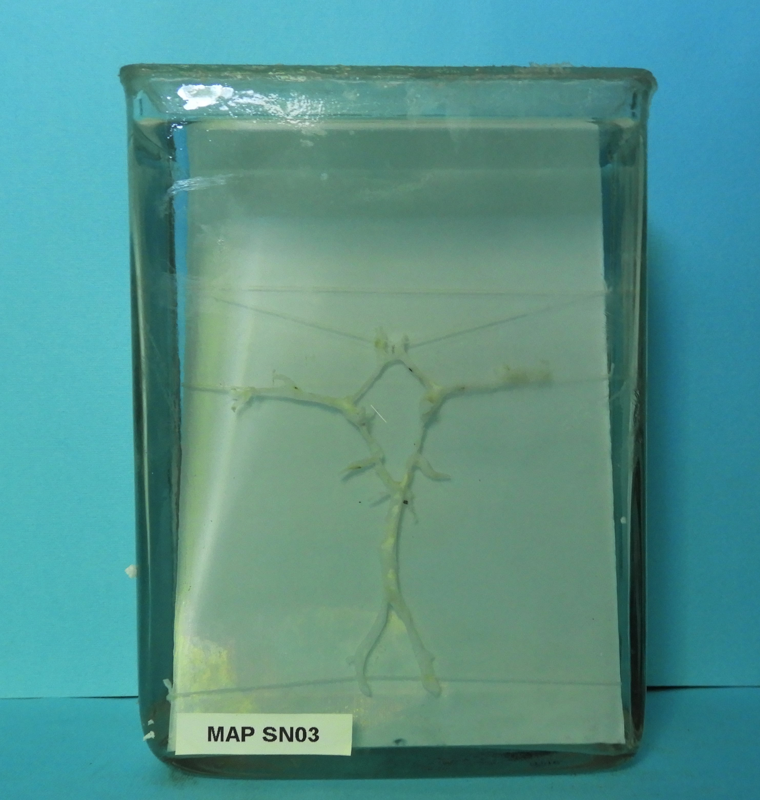 preparato anatomico, sistema nervoso (morfologia naturale) (SECOLI/ XX)