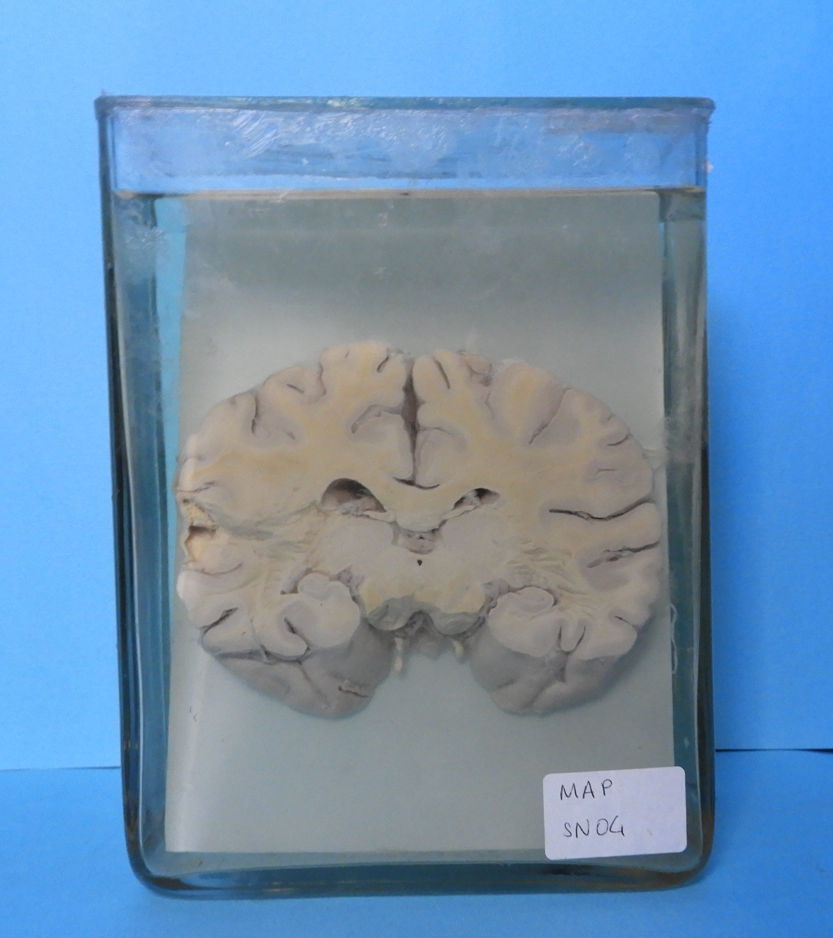 preparato anatomico, sistema nervoso (morfologia naturale) (SECOLI/ XX)