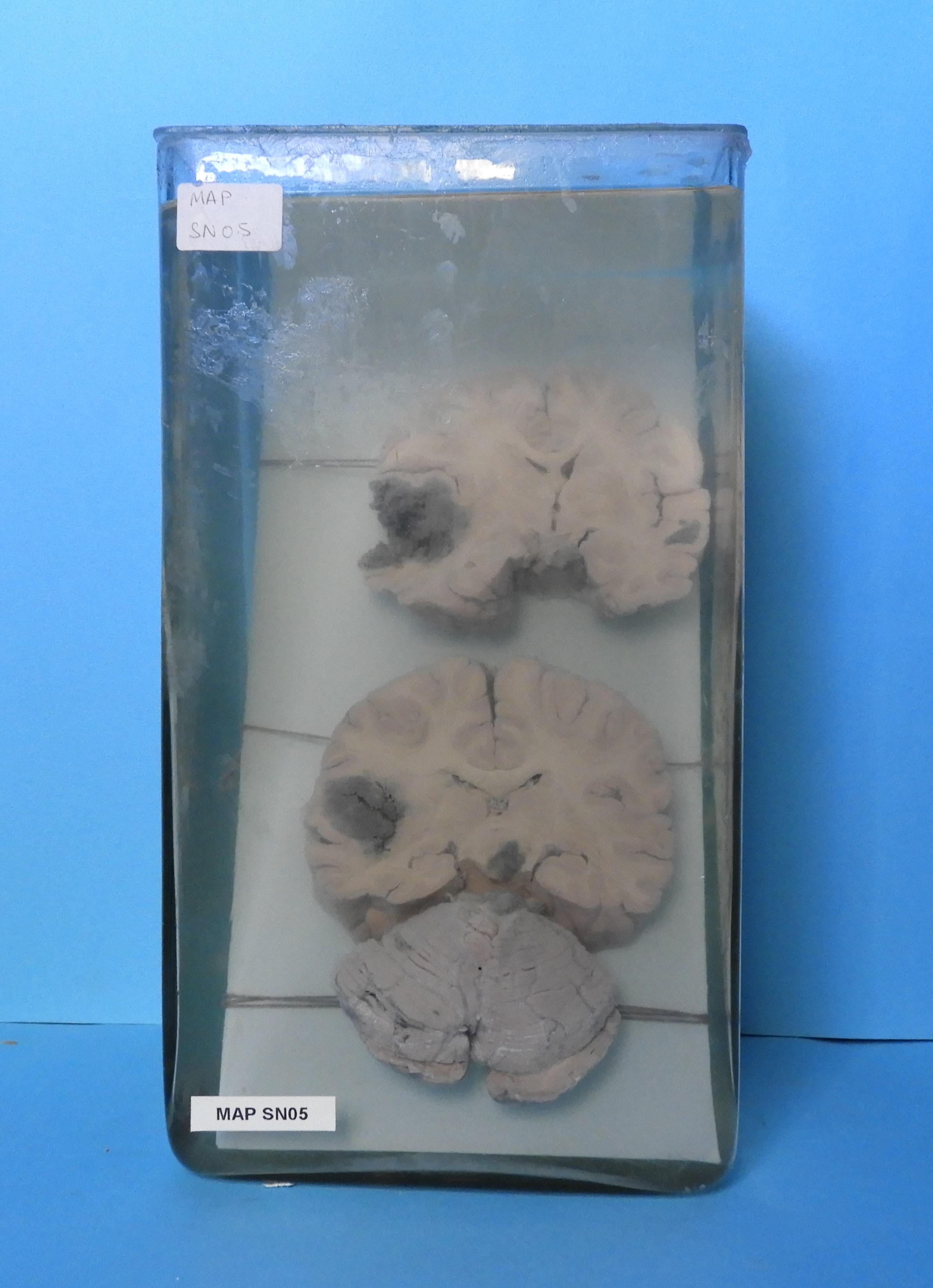 preparato anatomico, sistema nervoso (morfologia naturale) (SECOLI/ XX)