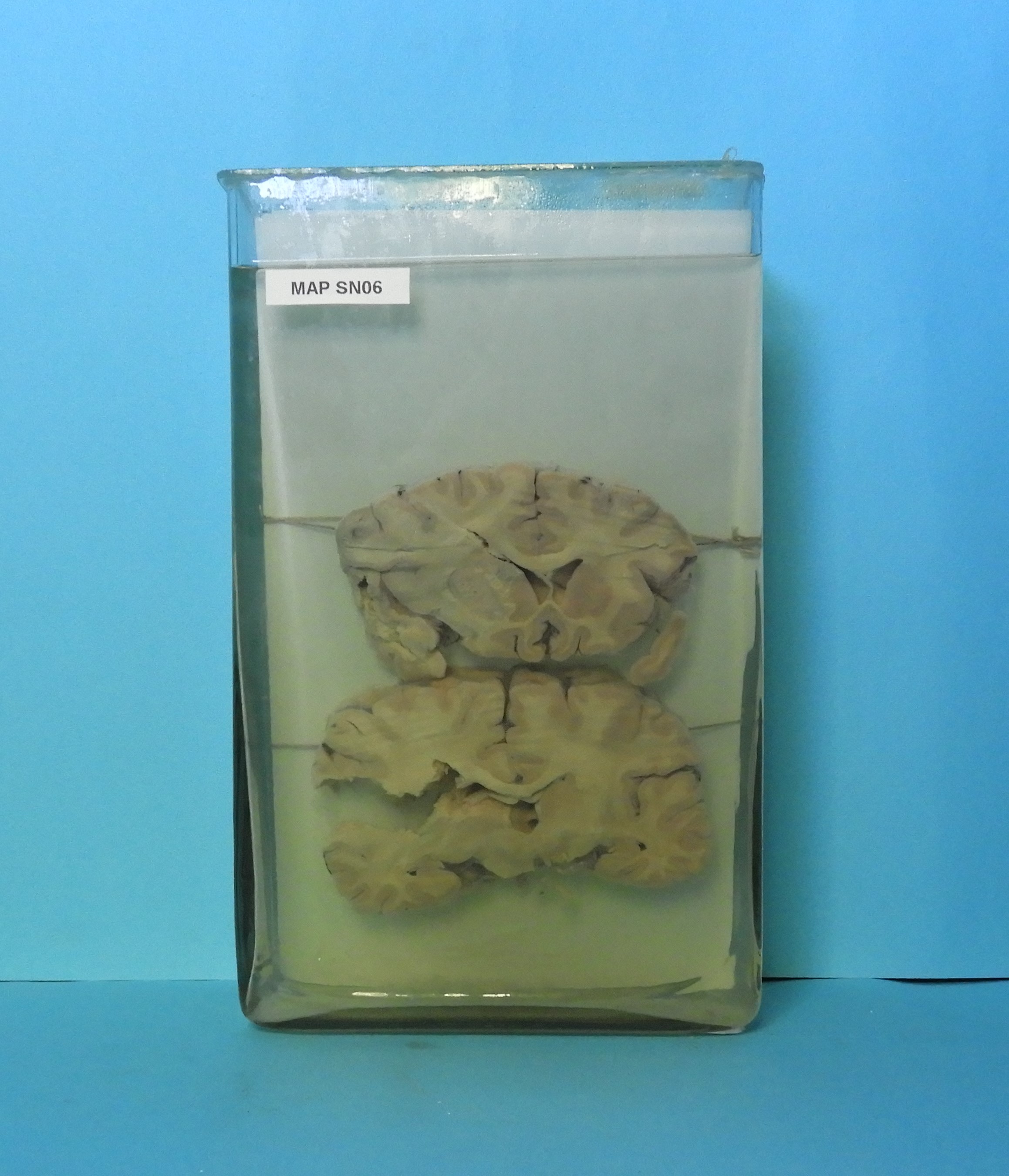 preparato anatomico, sistema nervoso (morfologia naturale) (SECOLI/ XX)