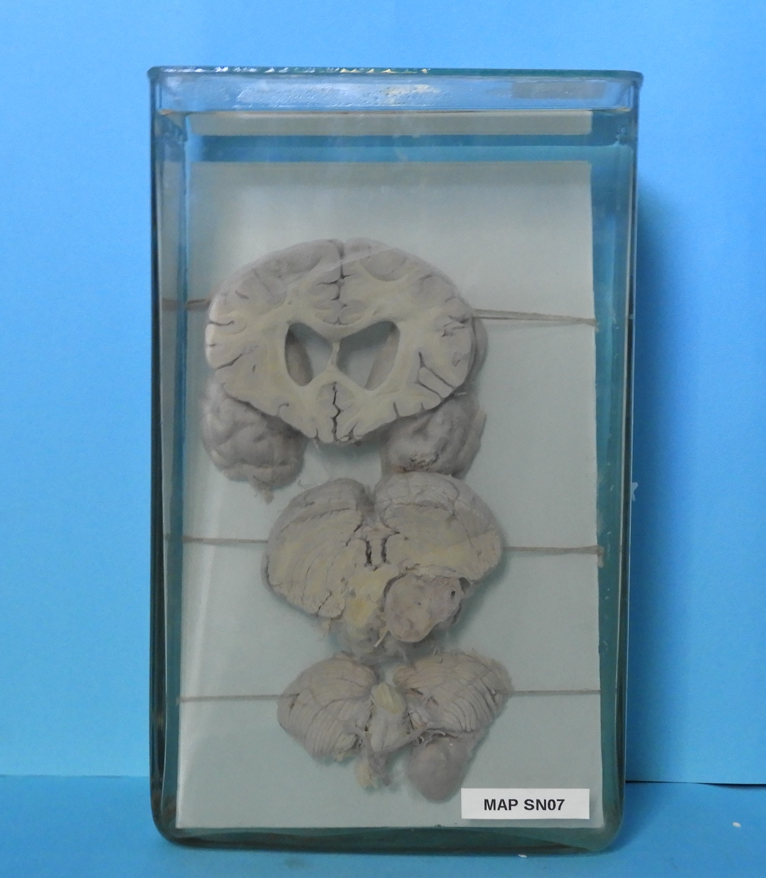 preparato anatomico, sistema nervoso (morfologia naturale) (SECOLI/ XX)