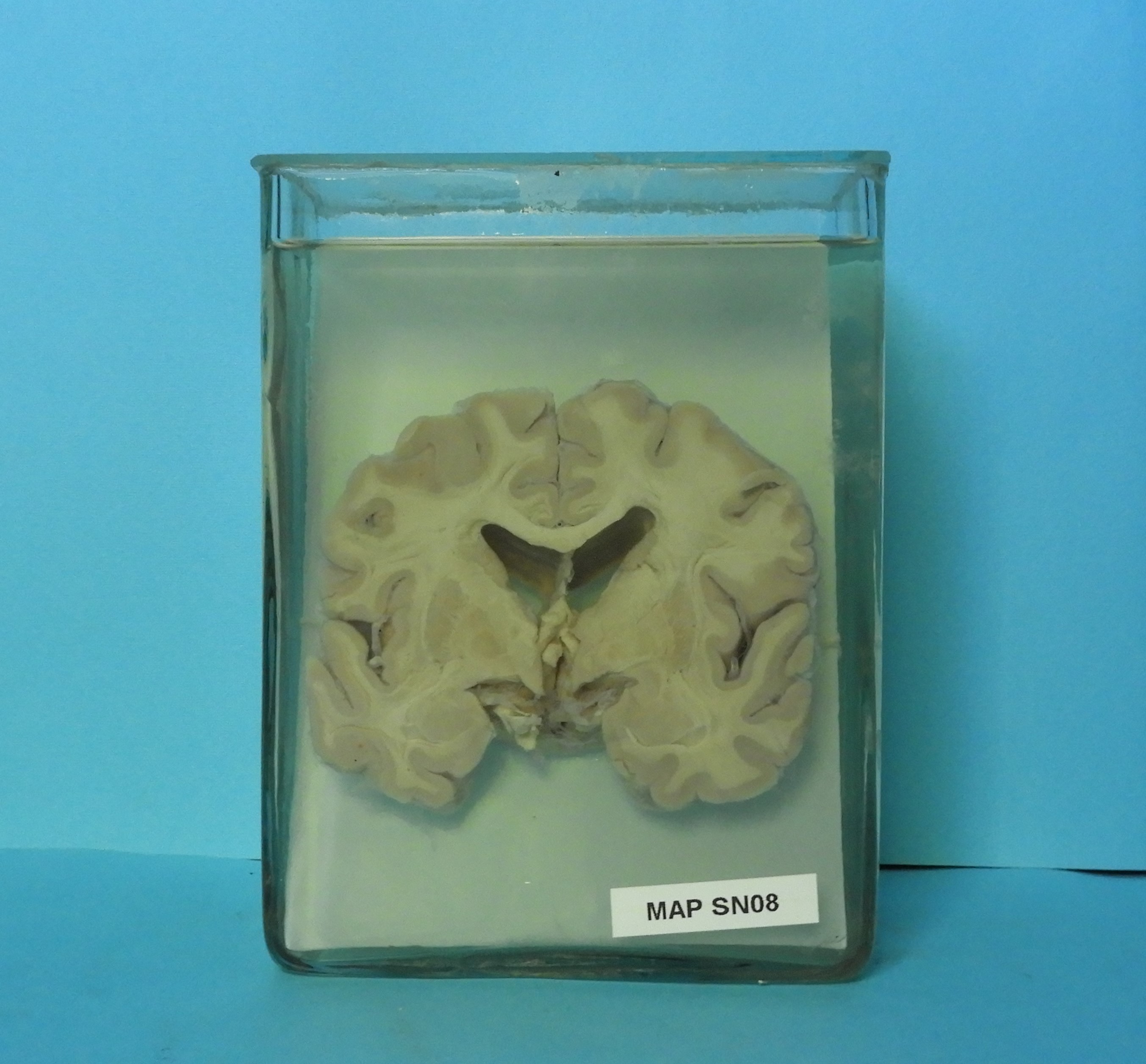 preparato anatomico, sistema nervoso (morfologia naturale) (SECOLI/ XX)