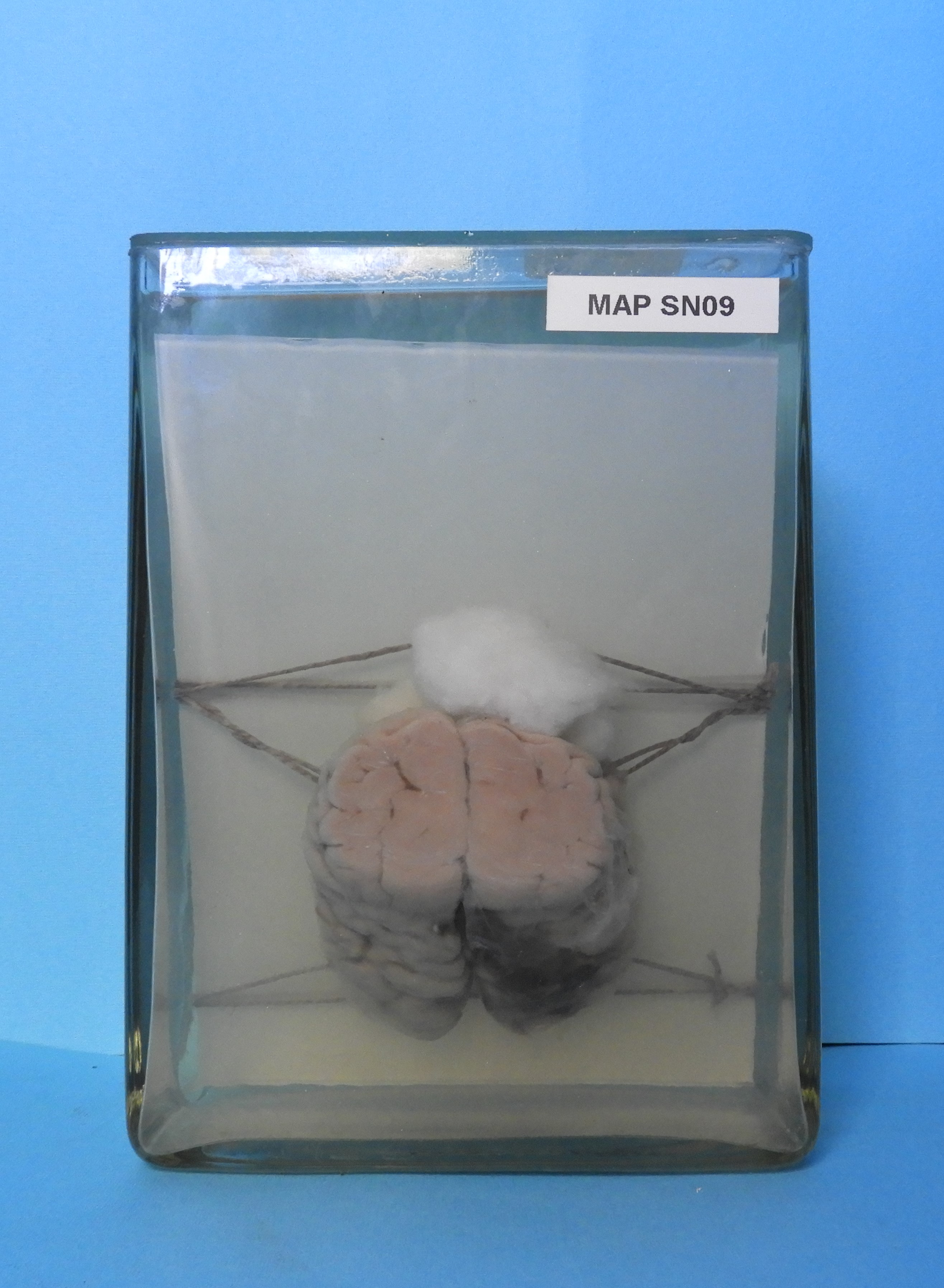 preparato anatomico, sistema nervoso (morfologia naturale) (SECOLI/ XX)