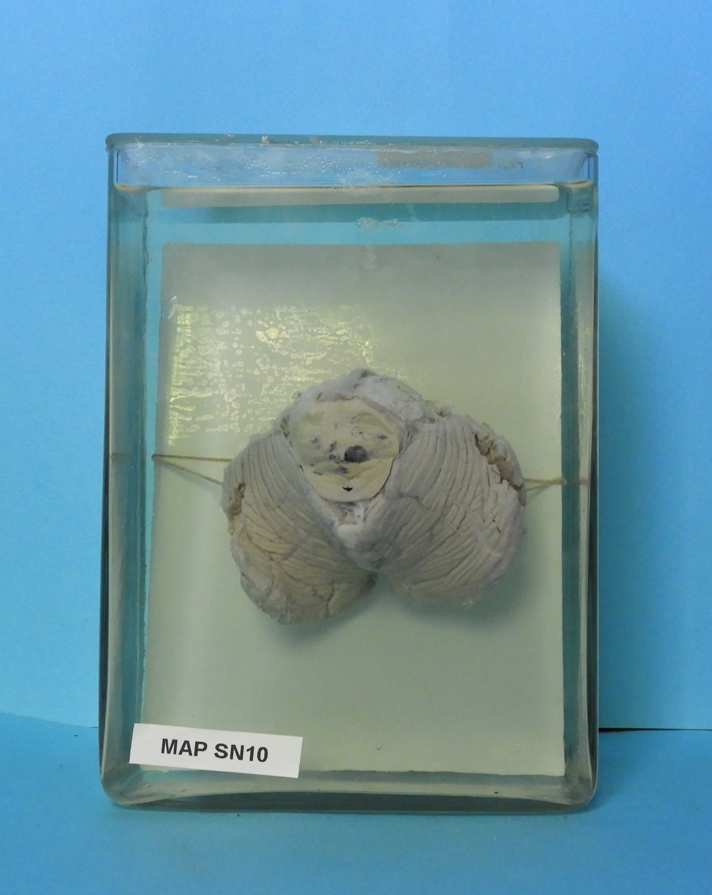 preparato anatomico, sistema nervoso (morfologia naturale) (SECOLI/ XX)