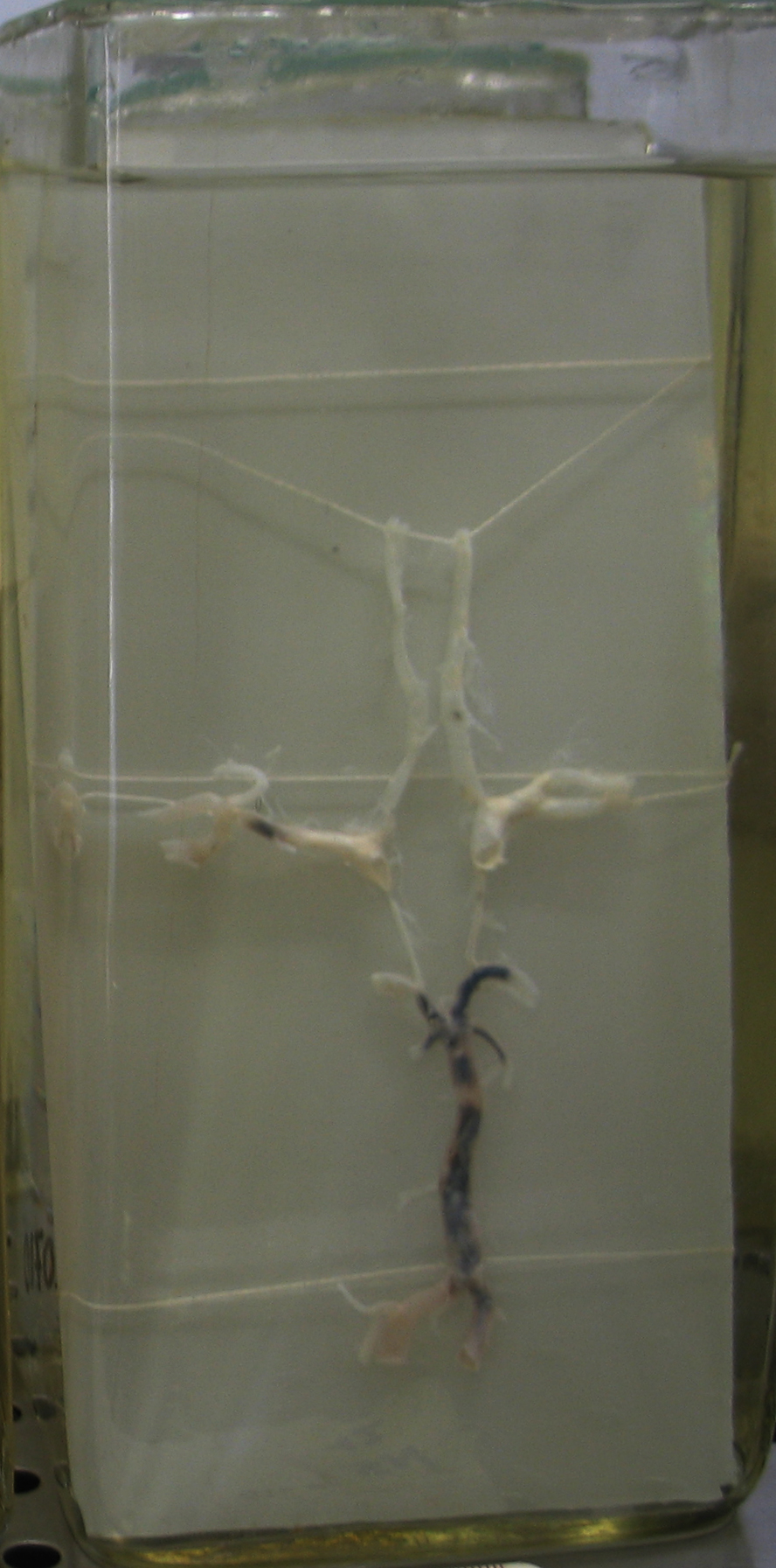 preparato anatomico, sistema nervoso (morfologia naturale) (SECOLI/ XX)