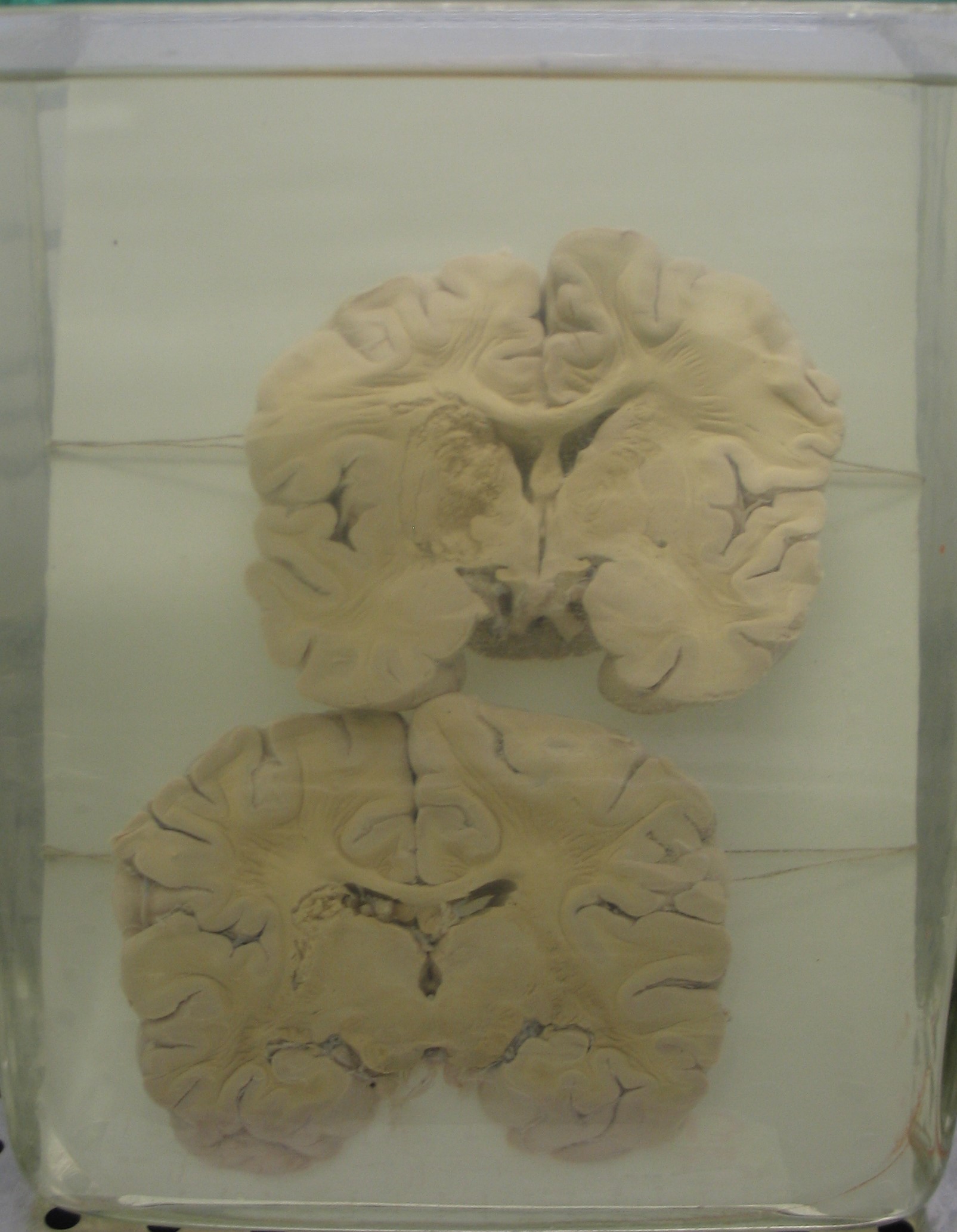 preparato anatomico, sistema nervoso (morfologia naturale) (SECOLI/ XX)