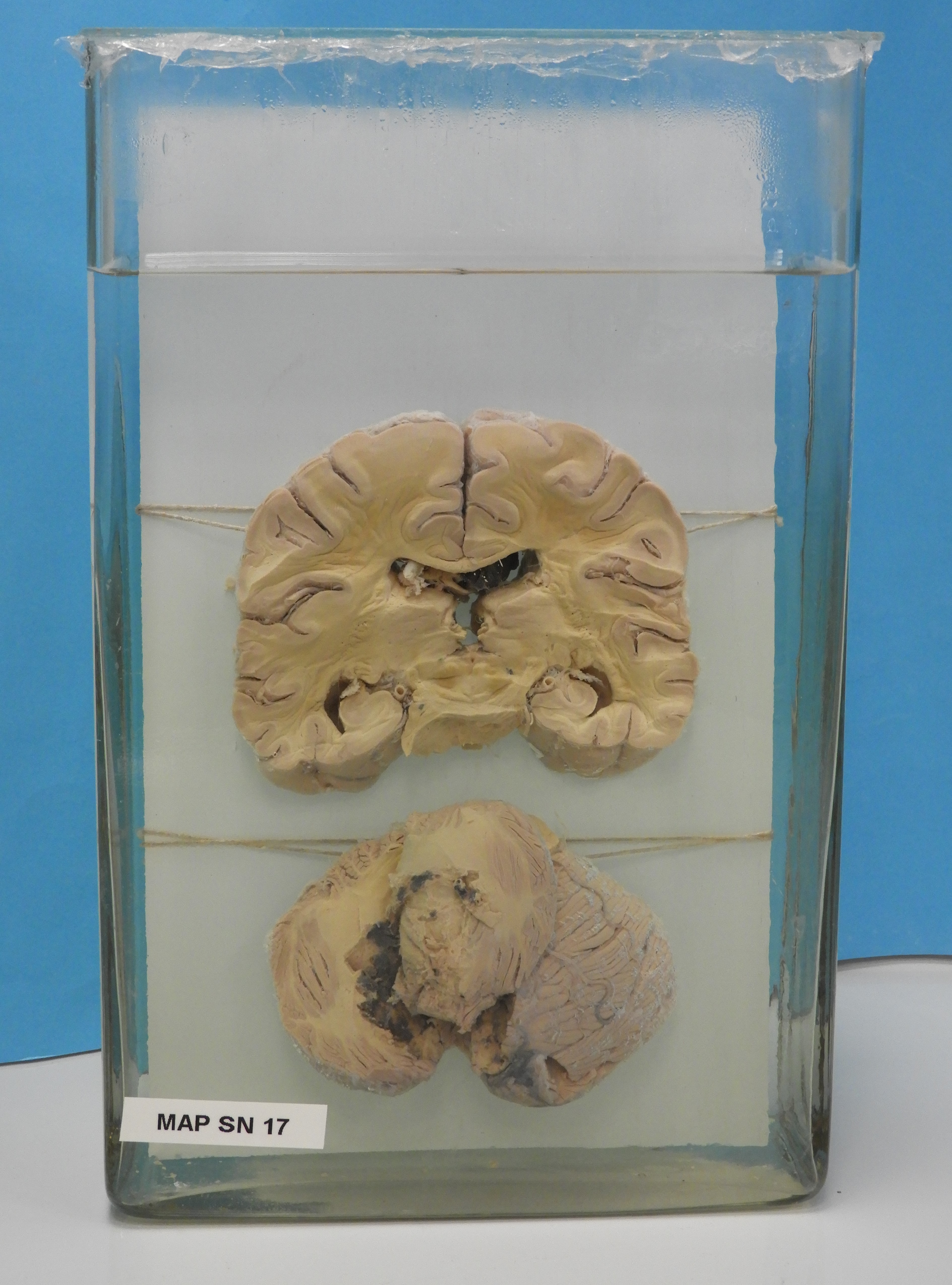 preparato anatomico, sistema nervoso (morfologia naturale) (SECOLI/ XX)