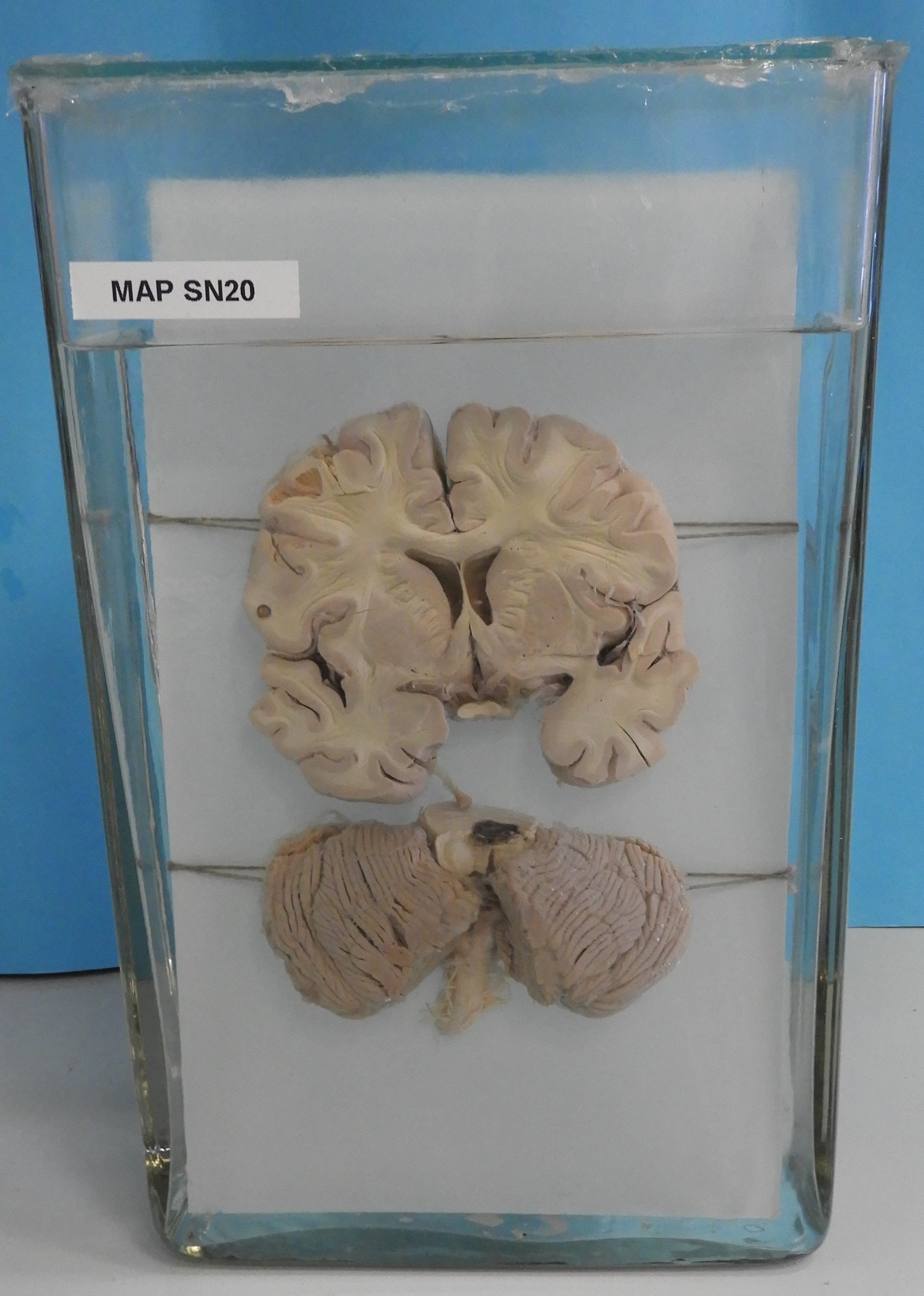 preparato anatomico, sistema nervoso (morfologia naturale) (SECOLI/ XX)